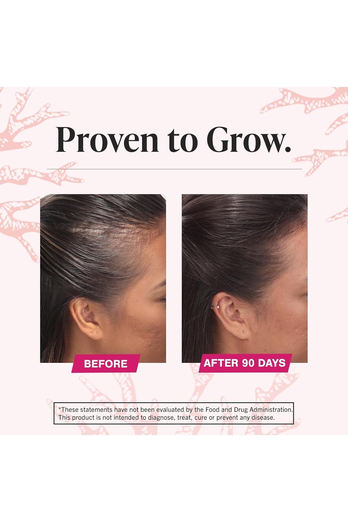 viviscal-Hair Growth Supplement For Women, 180 Tablets (3 MONTH SUPPLY) 7