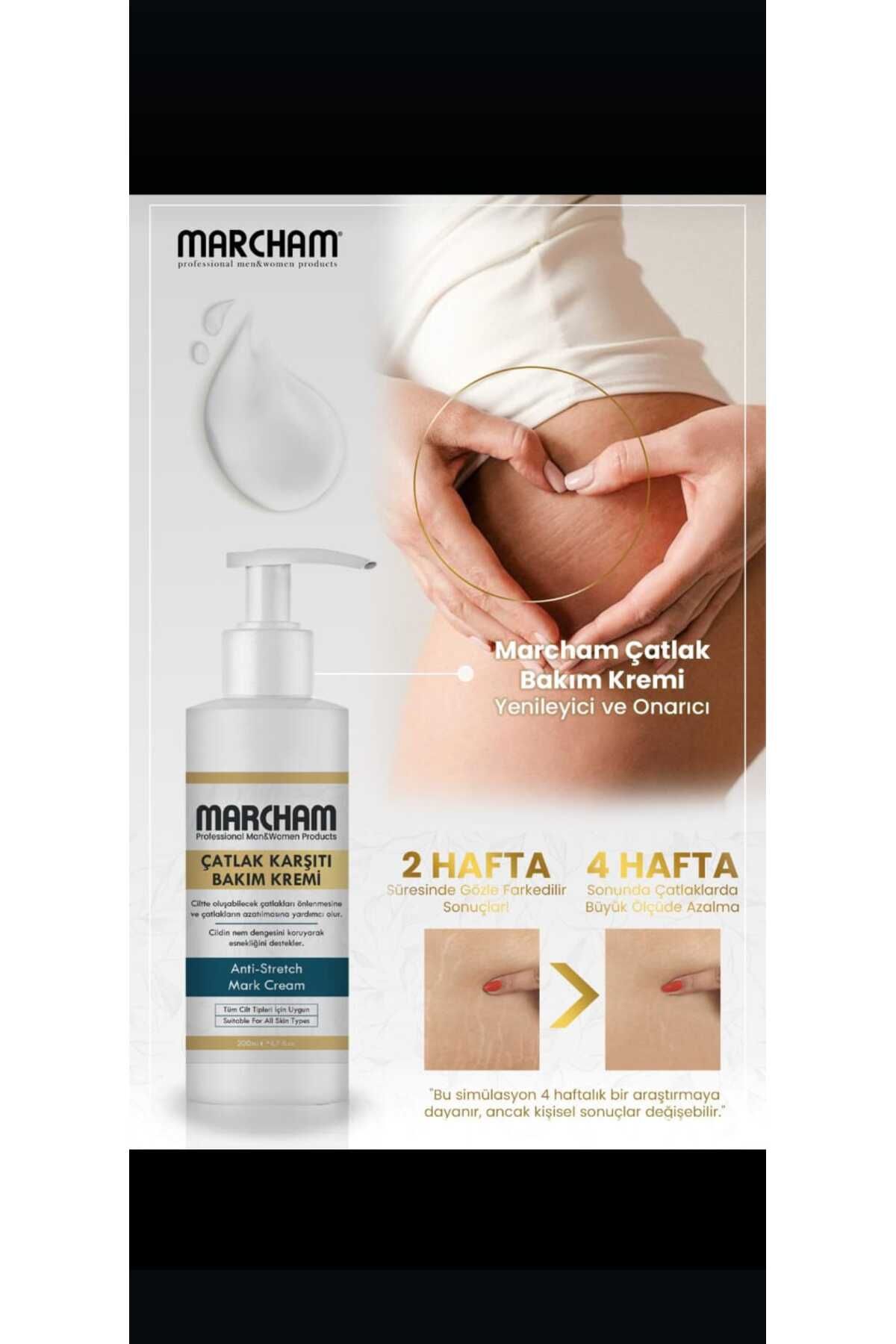 Marcham-Body Stretch Mark Cream Marcham Hand Foot Chest Buttocks Stretch Marks Remover 2