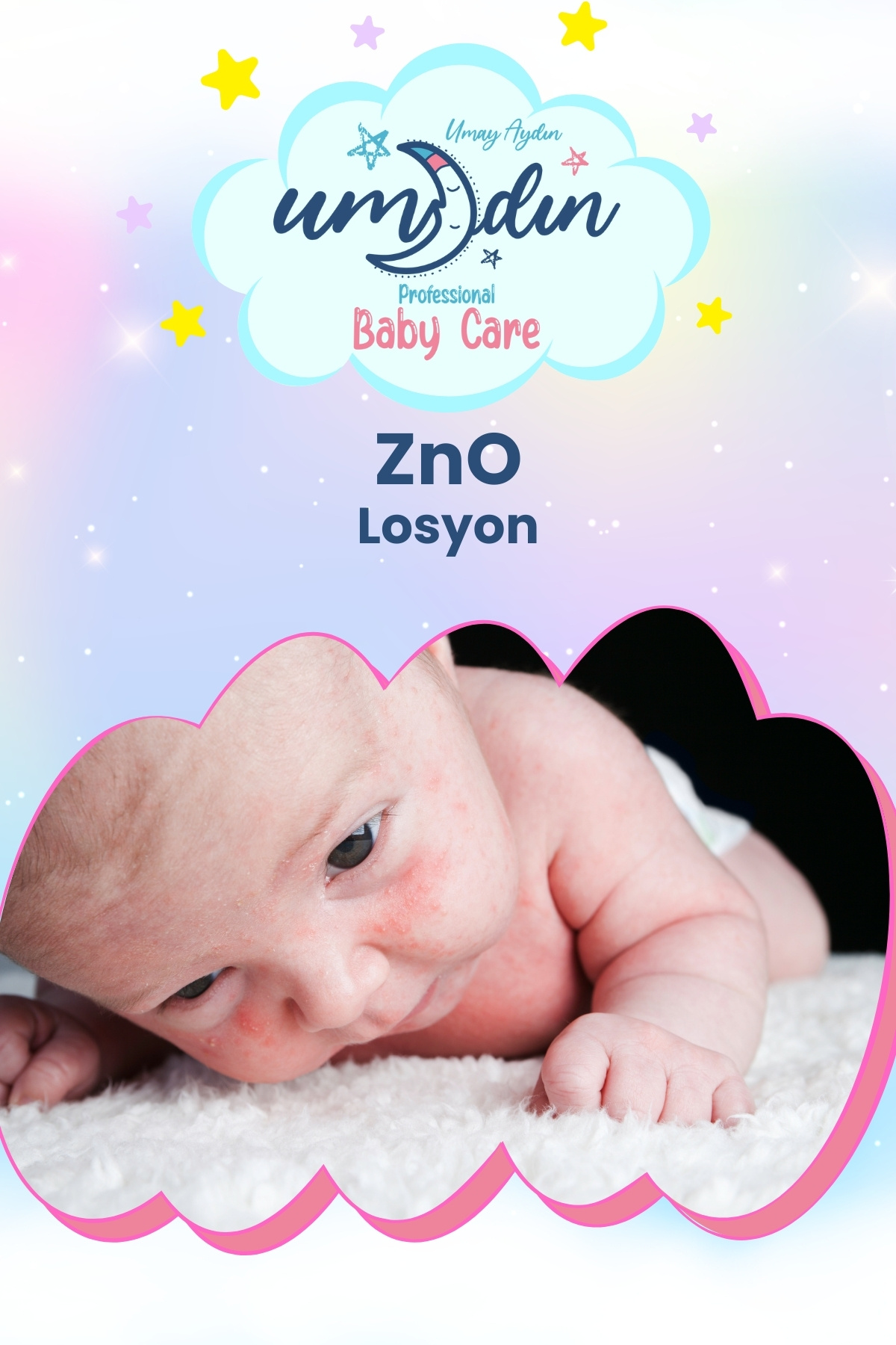 Naturaren ZnO Pişik ve İsilik Losyon 125 ML fotoğrafı 4 (önizleme)