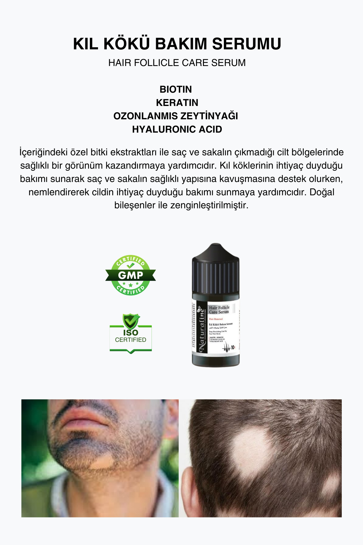 Kıl Kökü Bakım Serumu 30ml — AND142 — تصویر 4 از 5