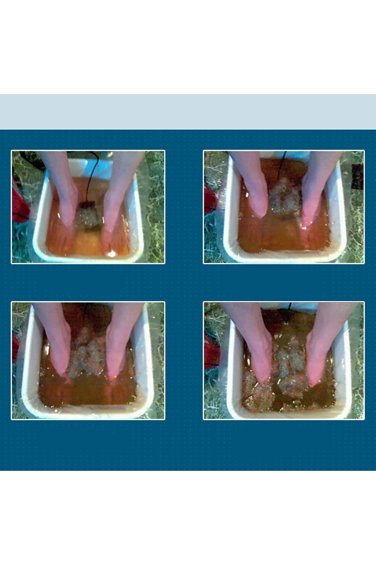 fulina-Arrays for Ionic Detox Foot Bath, Replacement for Ionic Foot Detox Machine Spa System 5