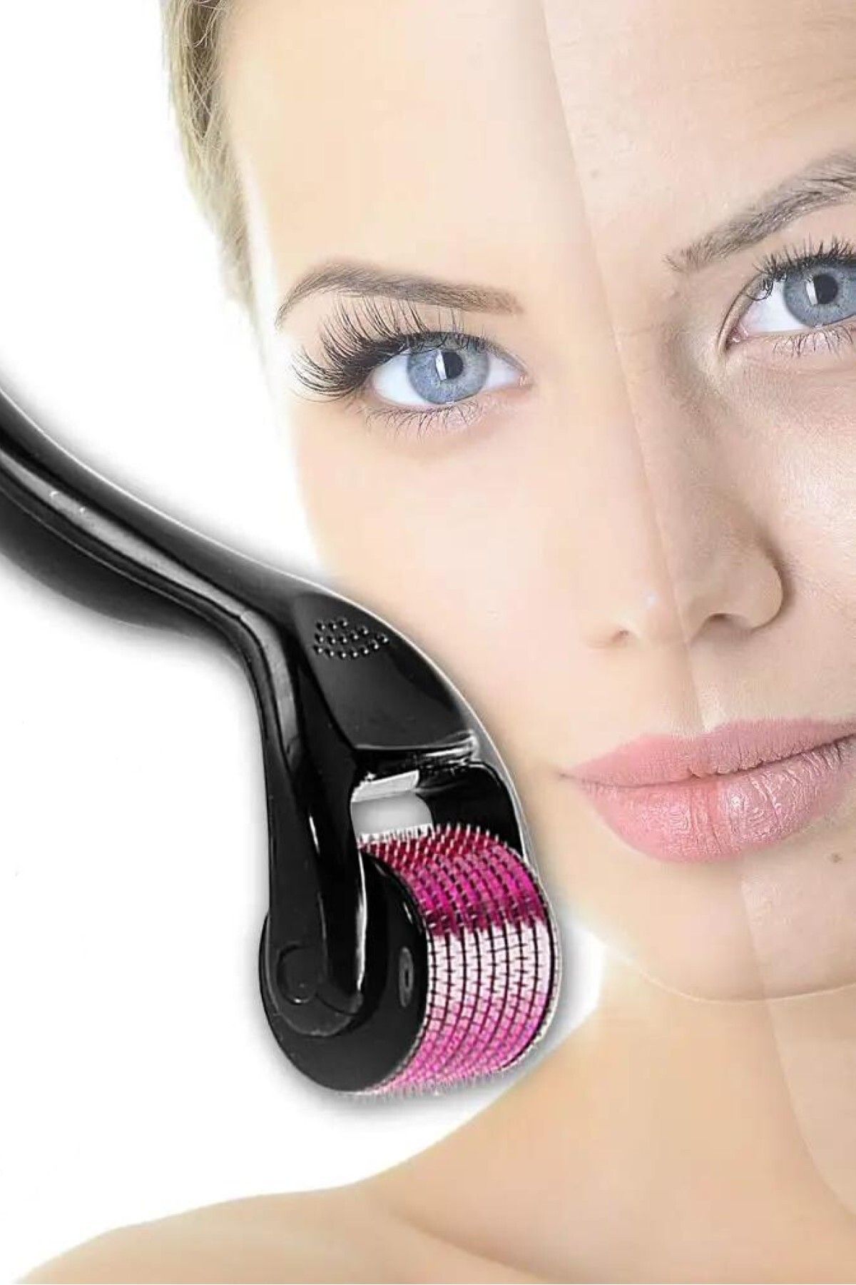 hayret sepeti Derma Roller Titanyum 1.00 mm ile Derinlemesine Cilt Yenileme
