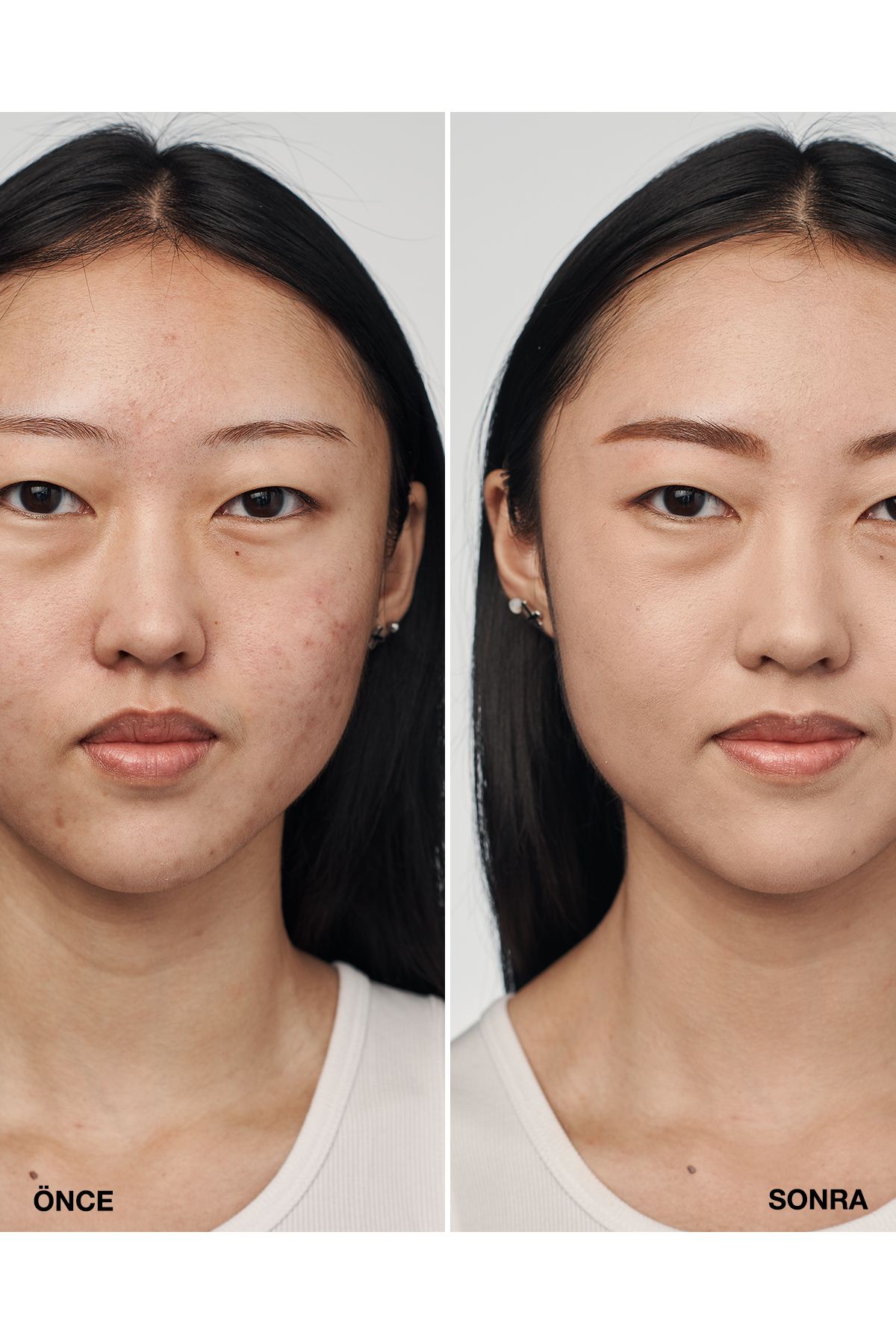 سرم Even Better Clinical™ Foundation Spf 20 - رنگ: Cn 28 Ivory (VF) - 30 میلی لیتر Clinique