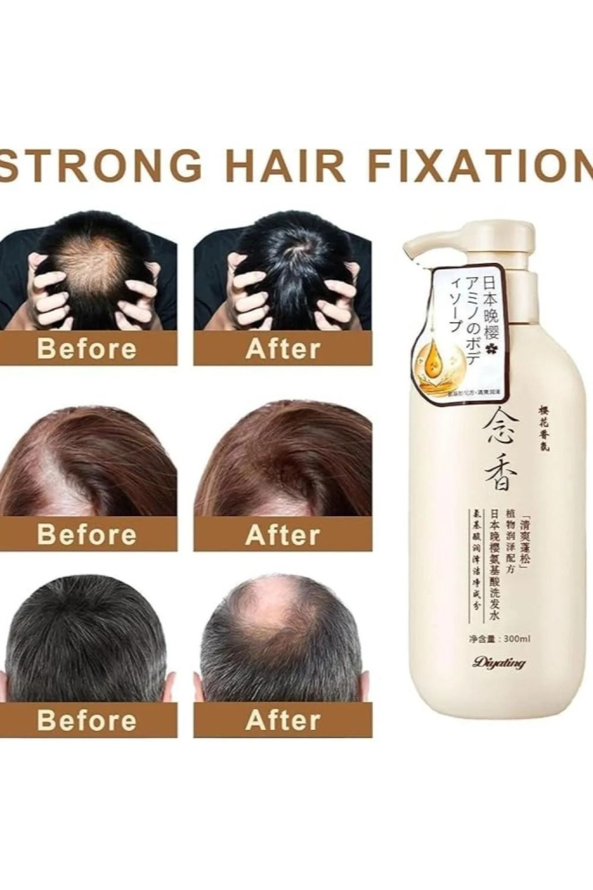 Sakura-Sakura Japanese Shampoo 300ml and Conditioner 300ml for Hair Growth, Preventing Hair Loss and Removing Dandruff 4