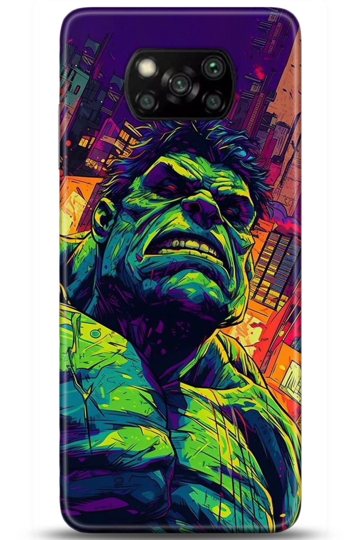 adveksiyon Xiaomi Poco X3 Pro Kılıf HD Baskılı Kılıf - Central Anatolia Series 5365