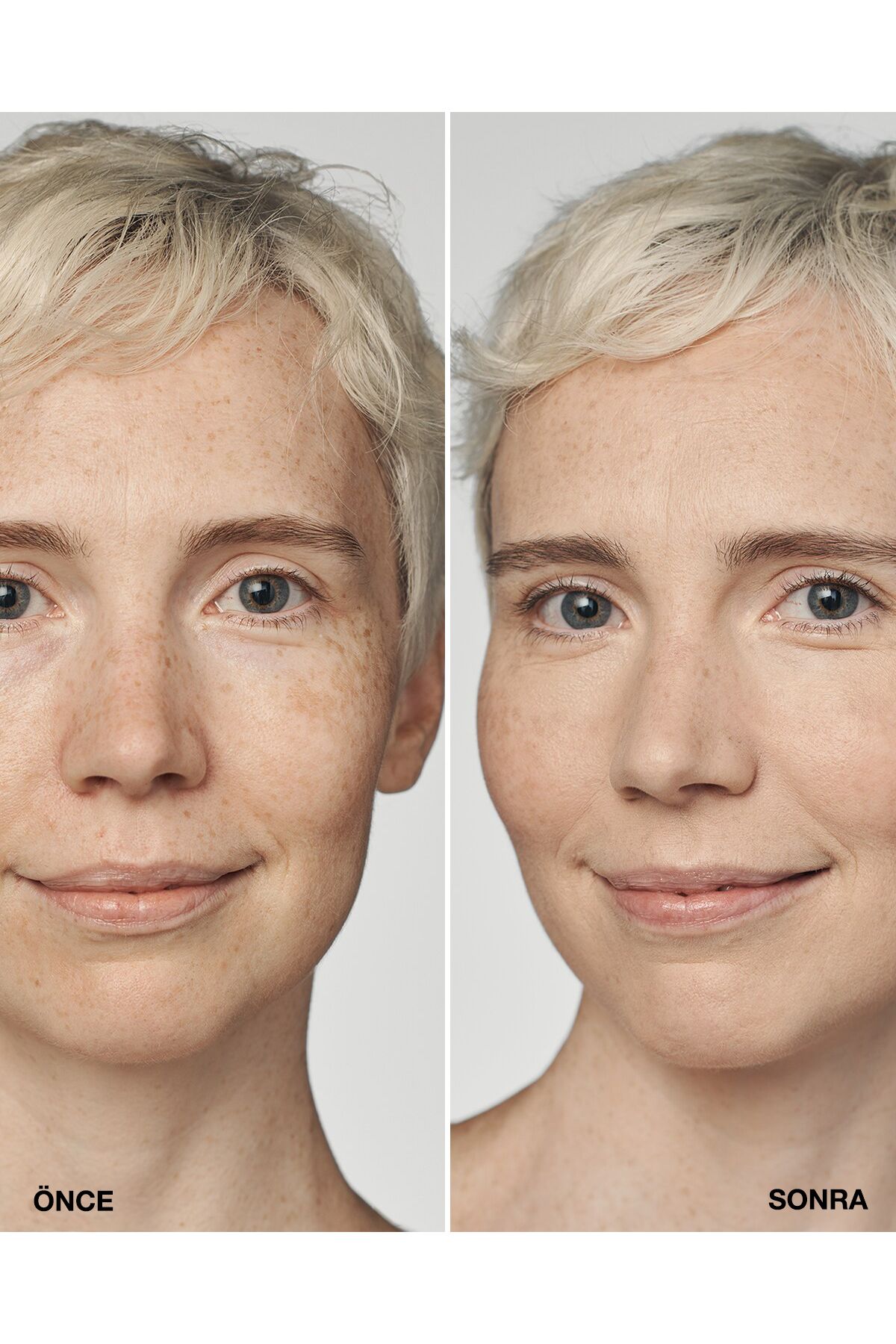 Clinique-Even Better Clinical ™   Serum Foundation Spf 20 - Color: Cn 08 Linen (Vf) - 30ml 2
