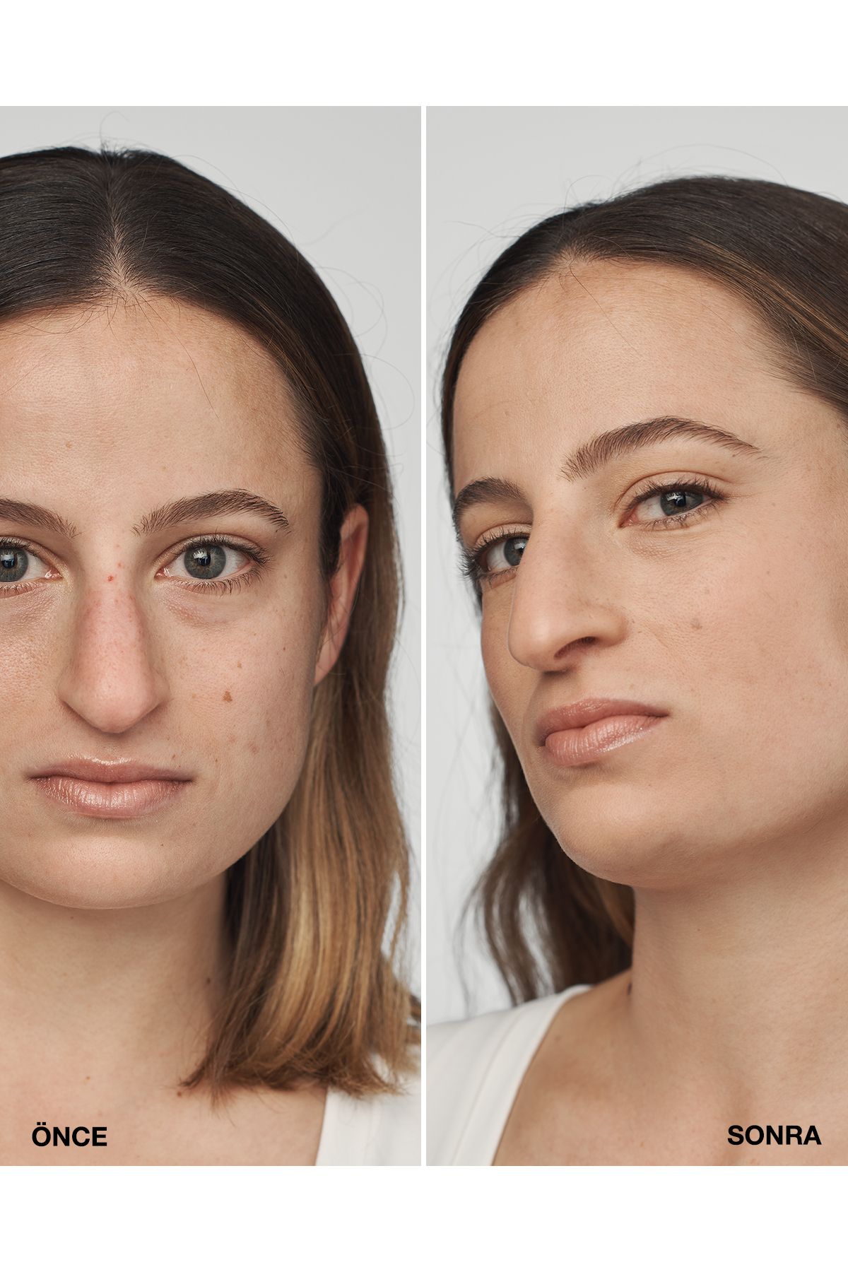 سرم Even Better Clinical™ Foundation Spf 20 - رنگ: Cn 40 کرم بابونه (VF) - 30 میلی لیتر Clinique