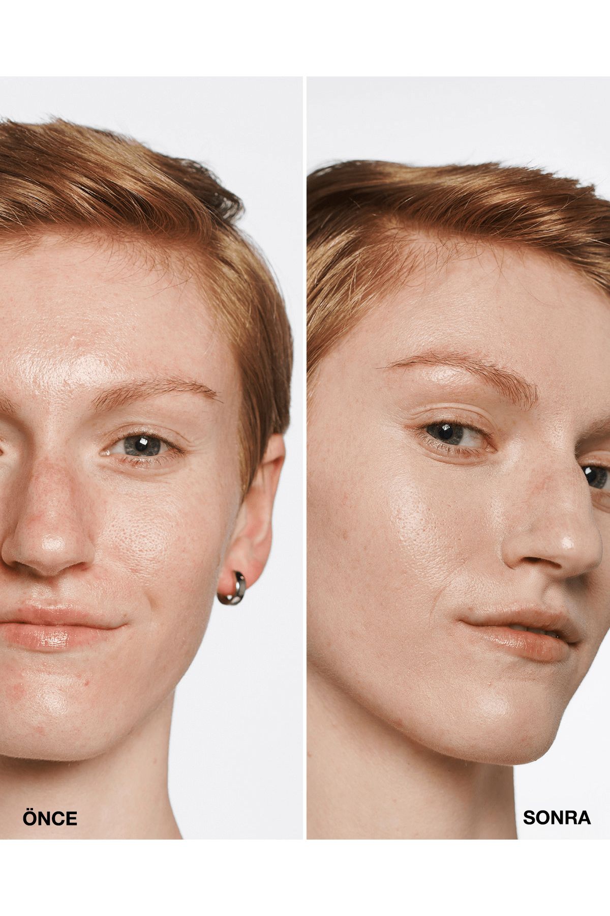 Clinique-Even Better ™   Natural Finish Foundation Spf 15 - Color: Cn 02 Breeze 30ml |   Vitamin C 3