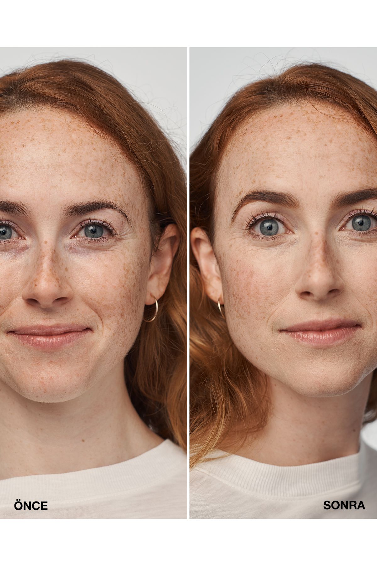 سرم Even Better Clinical™ Foundation Spf 20 - رنگ: Cn 10 Alabaster (VF) - 30 میلی لیتر Clinique