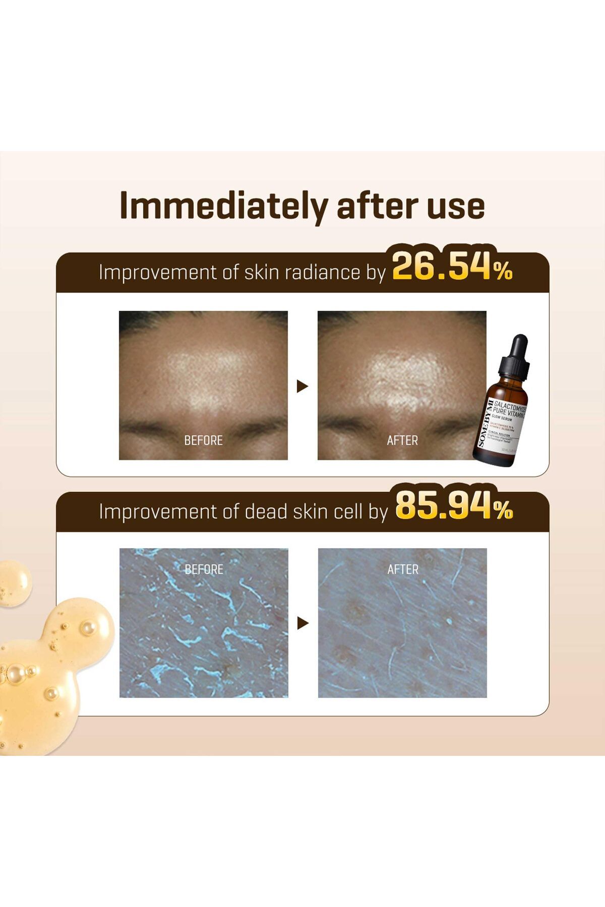 Some By Mi-Galactomyces Pure Vitamin C Glow Serum - Old Style that No longer Produced from 2023 7