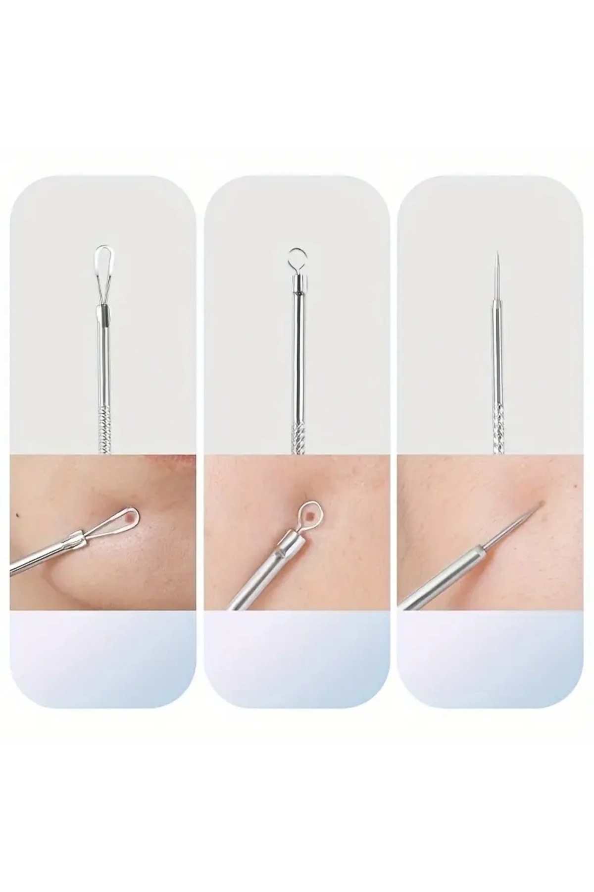 Ultra-ince No. 5 Siyah Nokta Cımbız Takımı 0.1mm Profesyonel Cımbız Alman Çelik — No:5 Cımbız Takımı B70 — تصویر 6 از 7