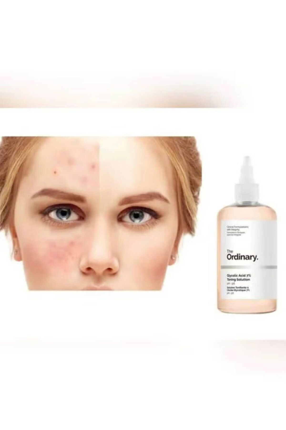 The Ordinary-240 مل حمض الجليكوليك 7% محلول منغم 3