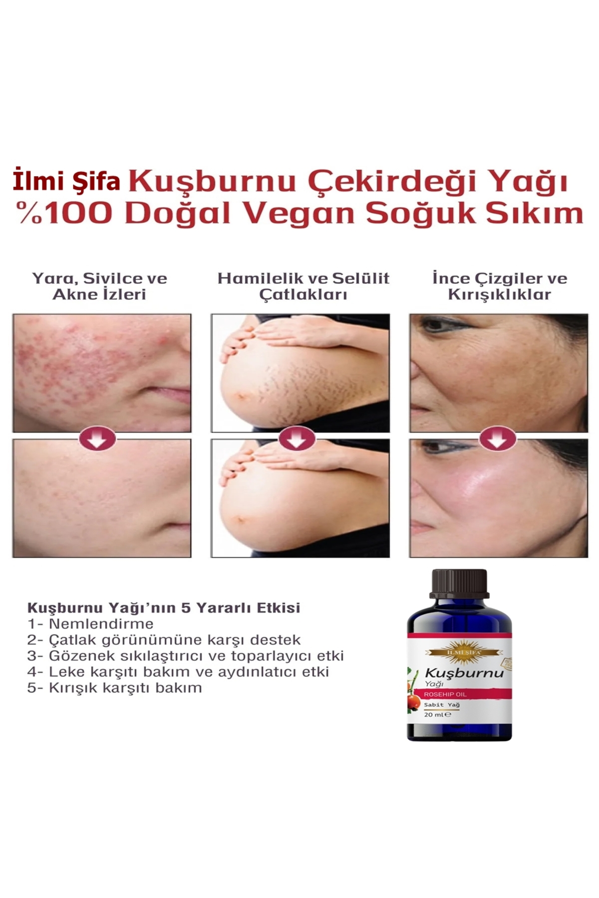 Kuşburnu Çekirdeği Yağı %100 Saf Kuşburnu Çekirdeği Yağı Soğuk Sıkım — تصویر 2 از 8