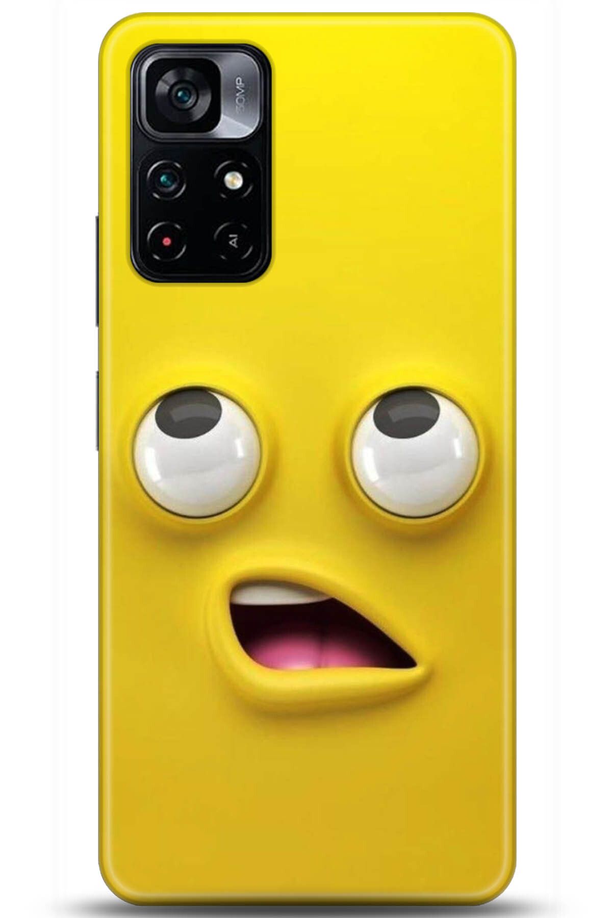 Noprin Xiaomi Poco M4 Pro 5G Kılıf HD Baskılı Kılıf - Loving You Series * 5133
