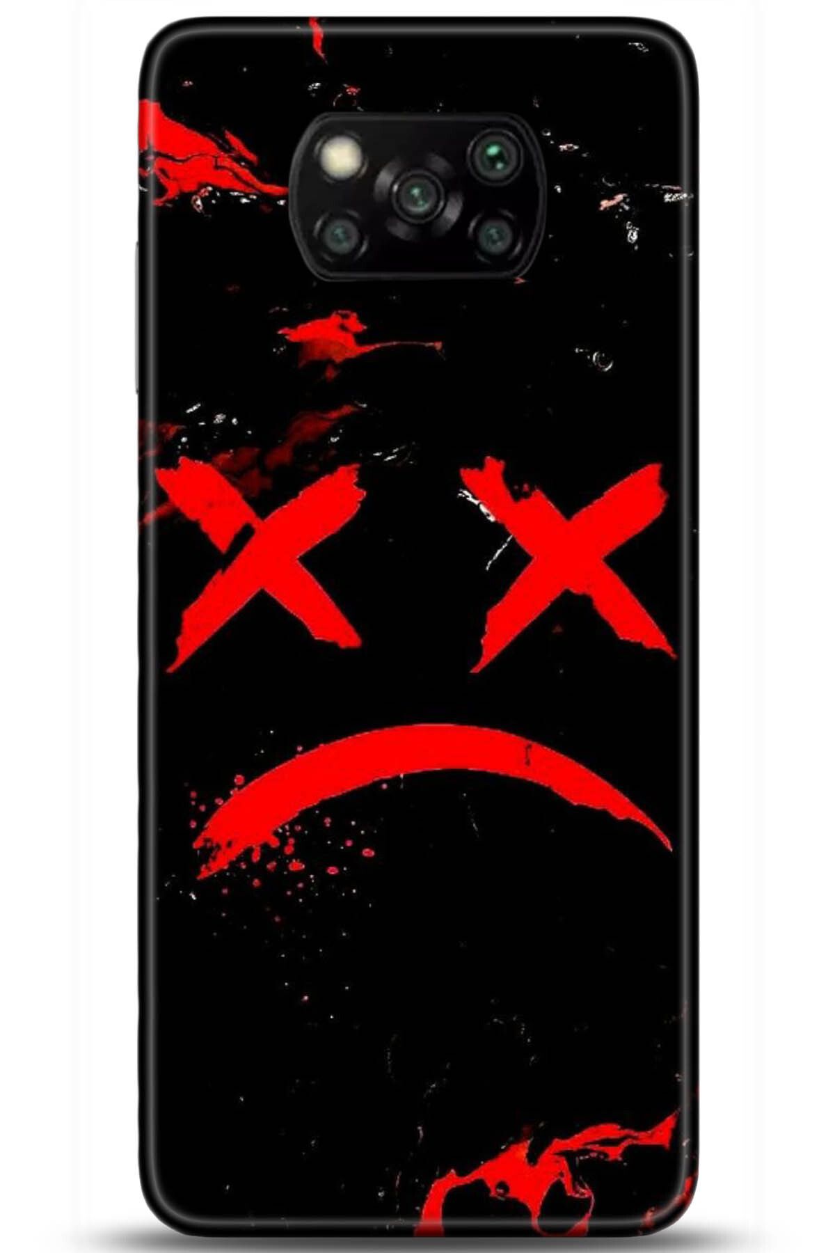 Noprin Xiaomi Poco X3 Kılıf HD Baskılı Kılıf - Loving You Series * 5139