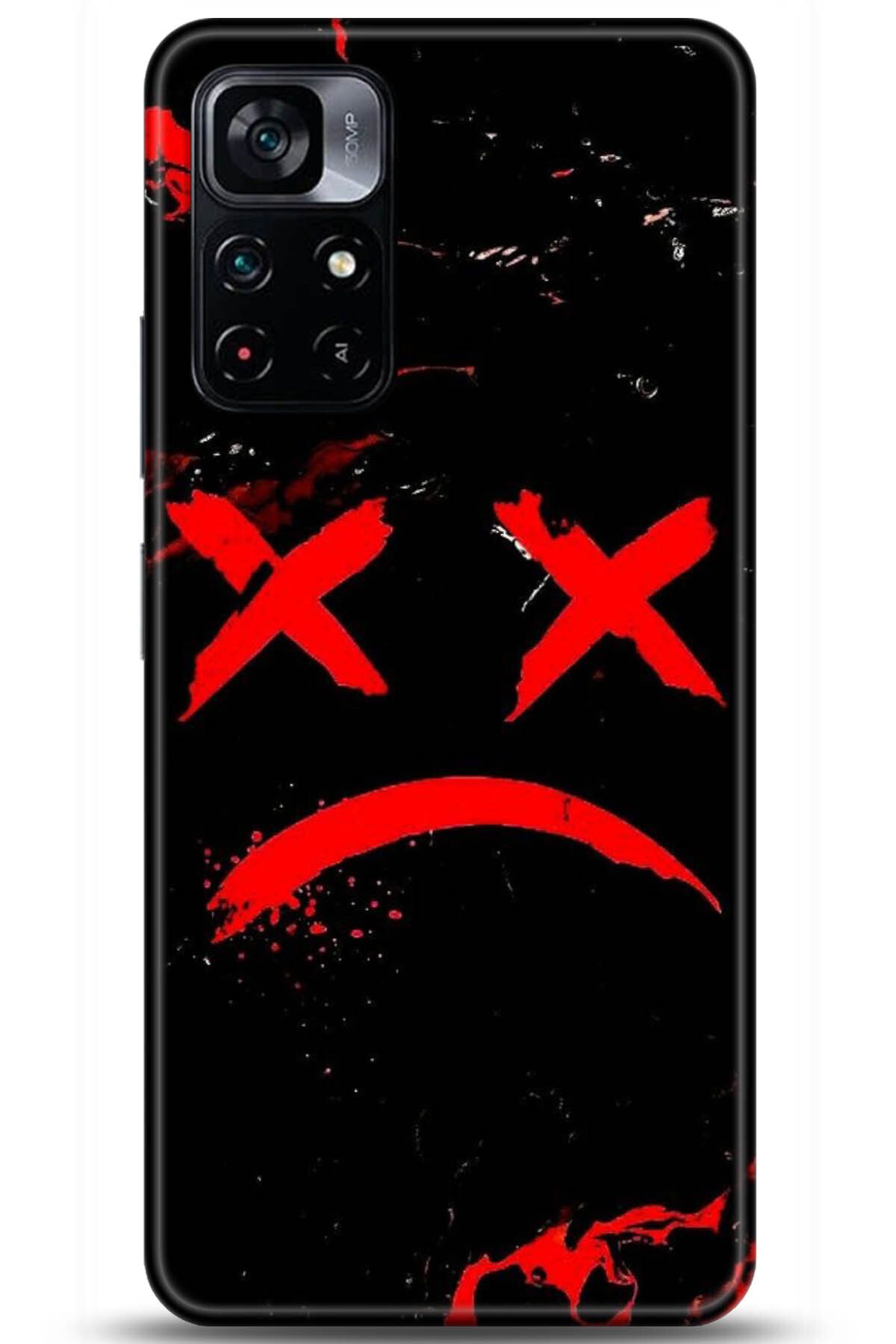 Noprin Xiaomi Poco M4 Pro 5G Kılıf HD Baskılı Kılıf - Loving You Series * 5139
