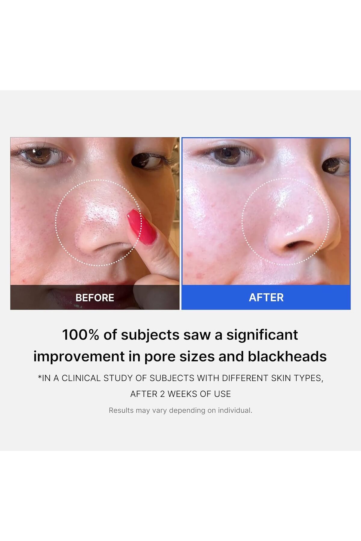 Medicube-All-in-One Duo for Pore & Texture Care: Zero Pore Pads 2.0 & Blackhead Mud Mask 3
