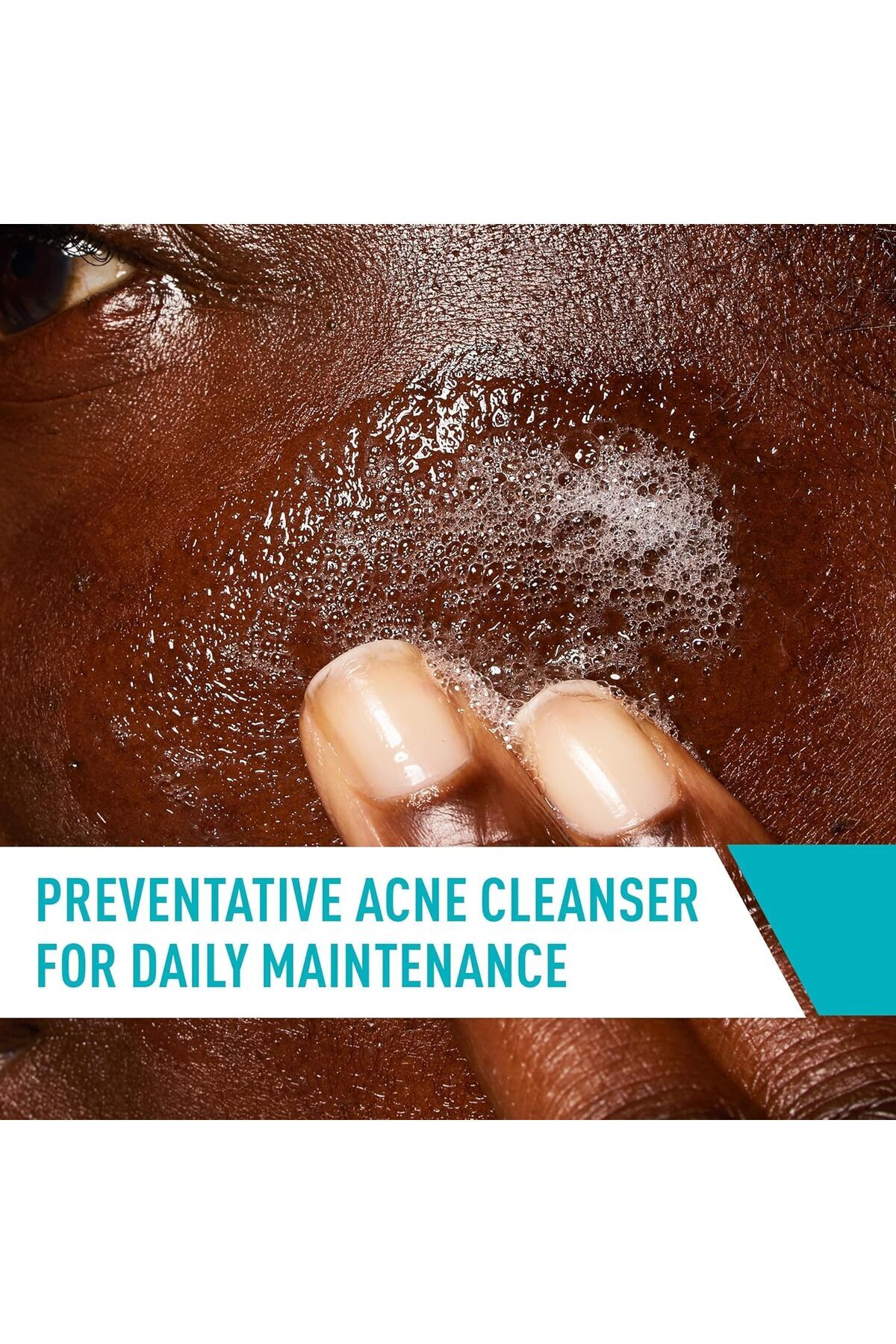 CeraVe-Acne Face Wash, Acne Cleanser with Salicylic Acid , 8 fl oz 6