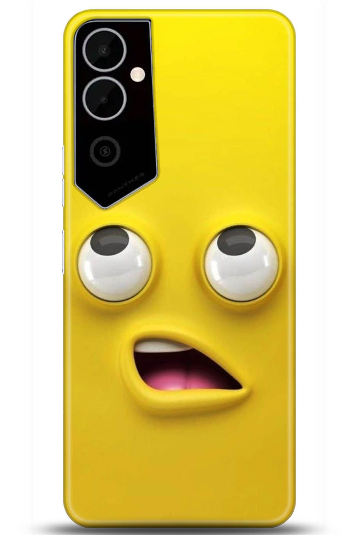 TECNO Pova Neo 2 Kılıf HD Baskılı Kılıf - My Passion Series 178169