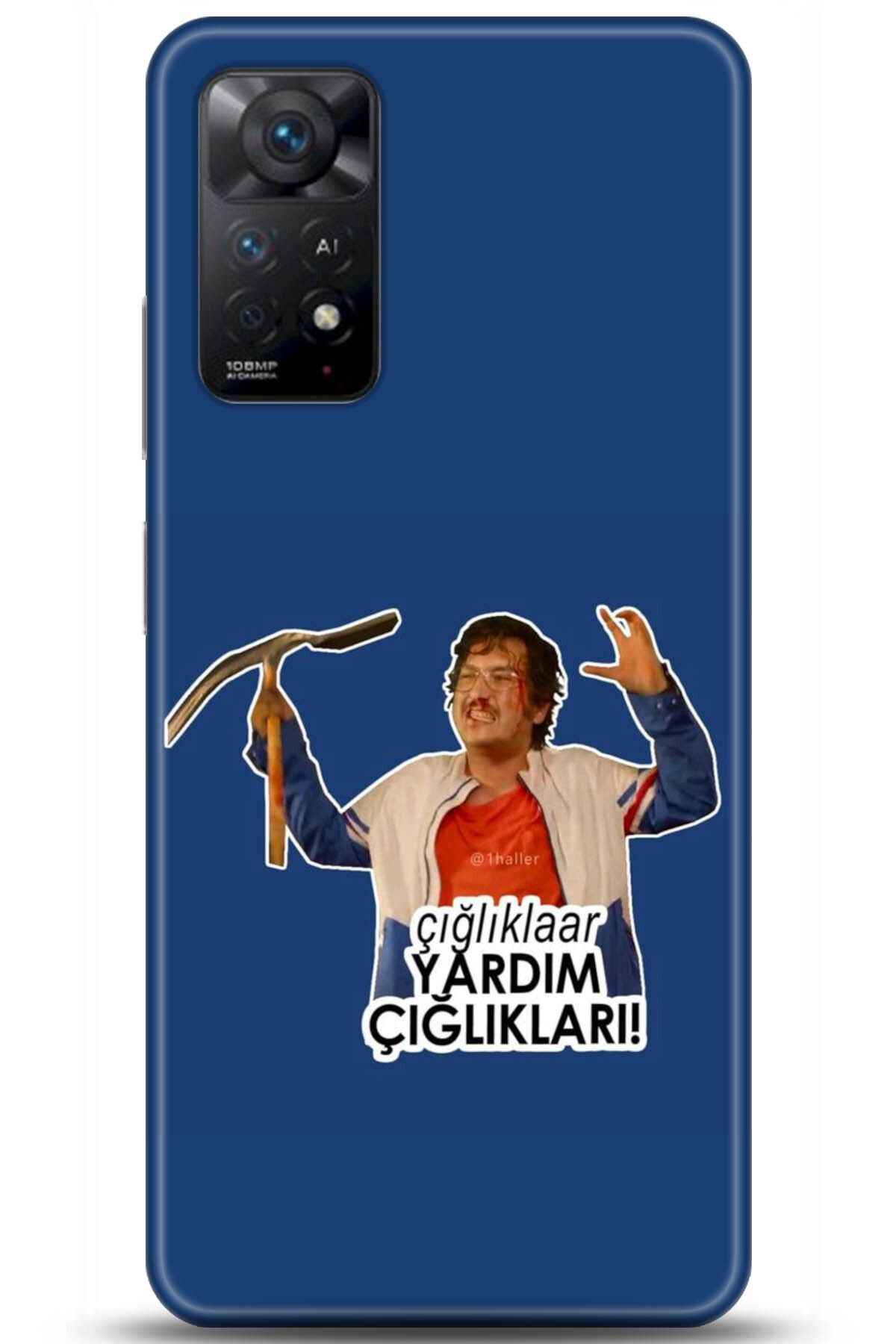 Noprin Xiaomi Redmi Note 11 Pro Kılıf HD Baskılı Kılıf - My Passion Series 178820