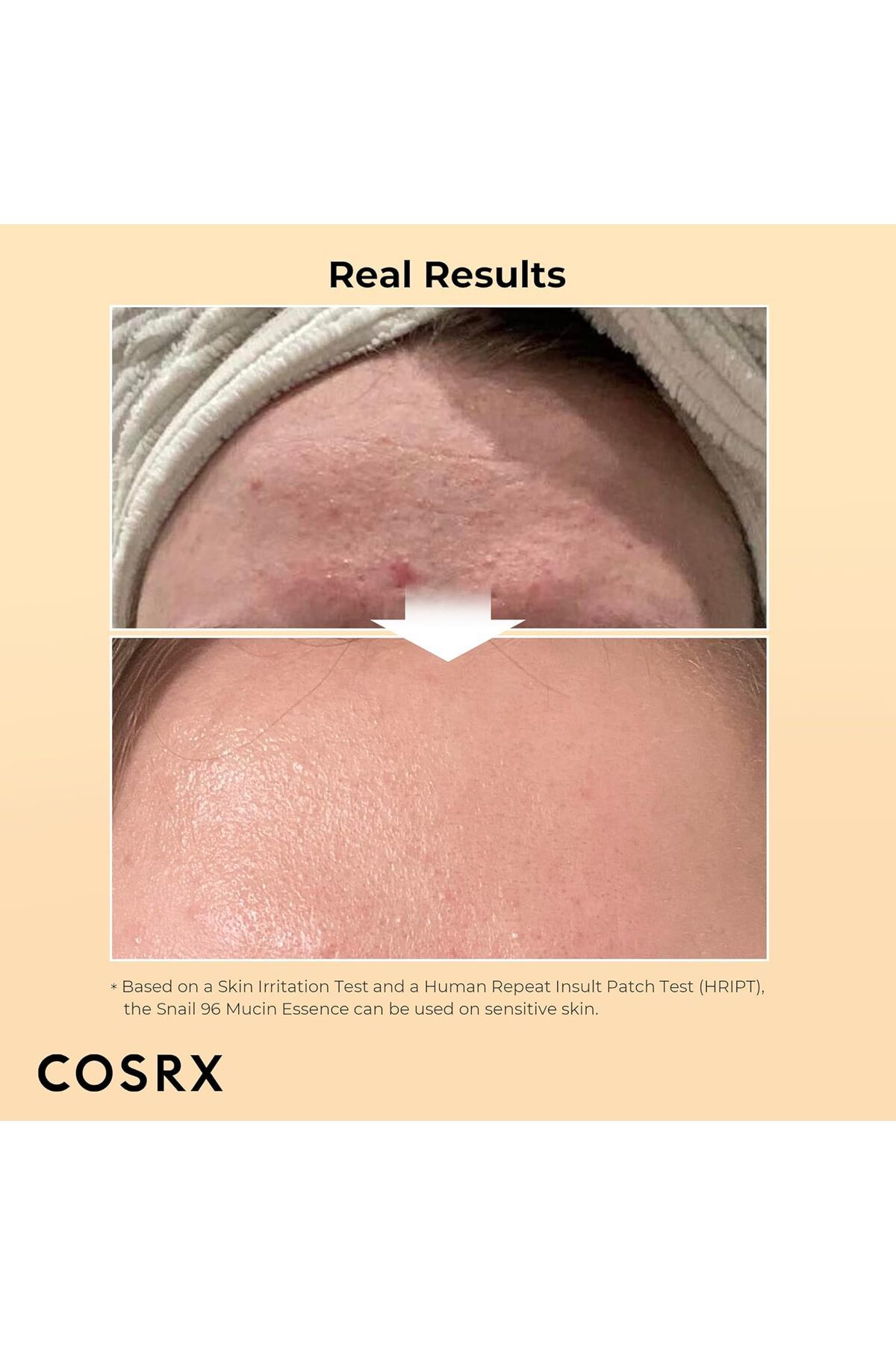 Cosrx-100ml Advanced Snail 96 Mucin Power Essence - Moisturizing And Nourishing Essence With Snail Essence 6