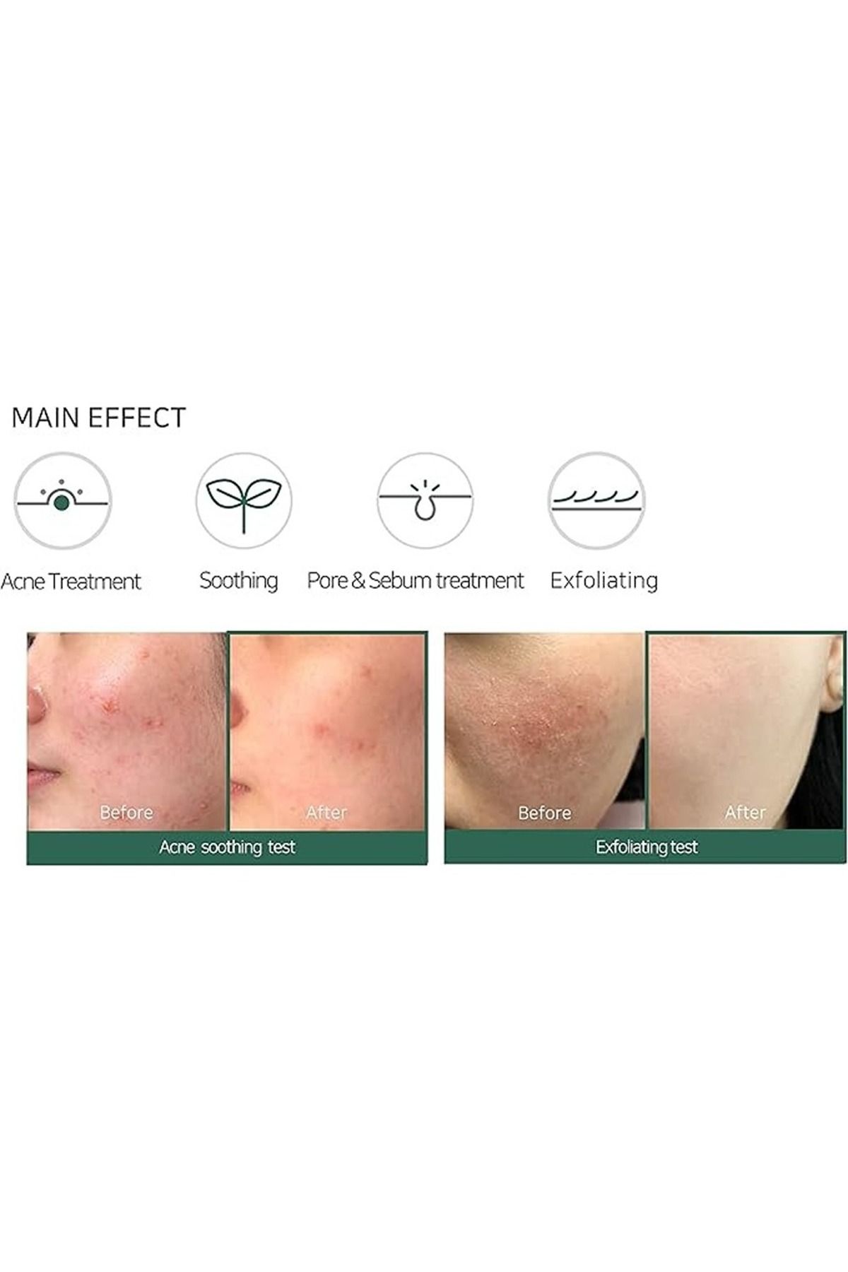 Some By Mi-Korean AHA BHA PHA 30 Days Miracle Acne Clear Foam - 100Ml 5
