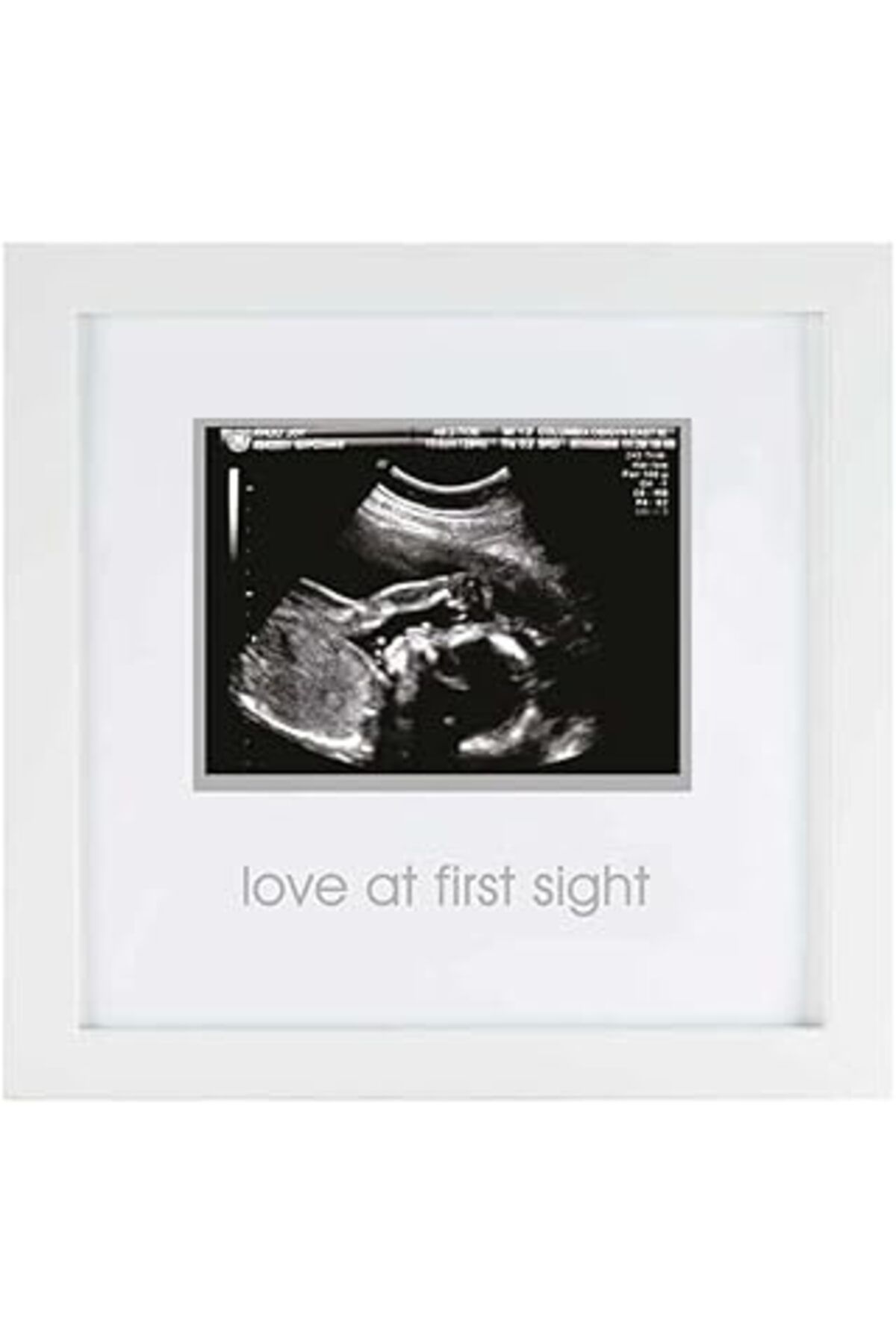 Pazarcan Pearhead İlk Görüşte Aşk Sonogram Resim Çerçevesi, Hamilelik Hatırası Fotoğraf Çerçevesi, Cinsiyets