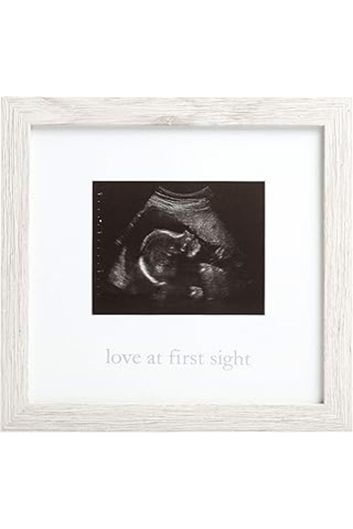 Pazarcan Kate & Milo Rustik Sonogram İlk Görüşte Aşk Çerçevesi, Ebeveyn Hediyesi Bekleniyor, Ultrason Resim