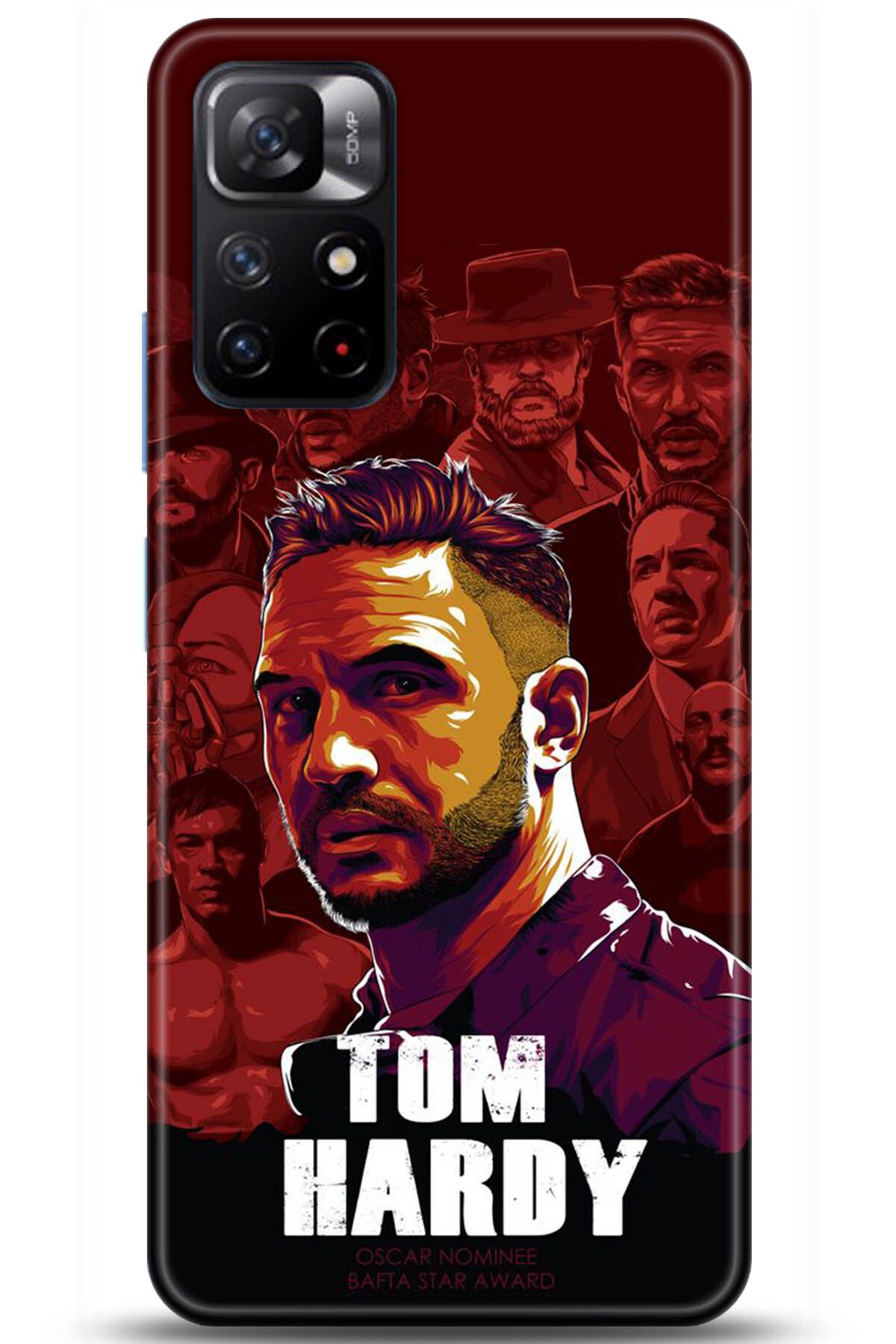 Noprin Xiaomi Redmi Note 11 Kılıf HD Baskılı Kılıf - Happiness Series 5225