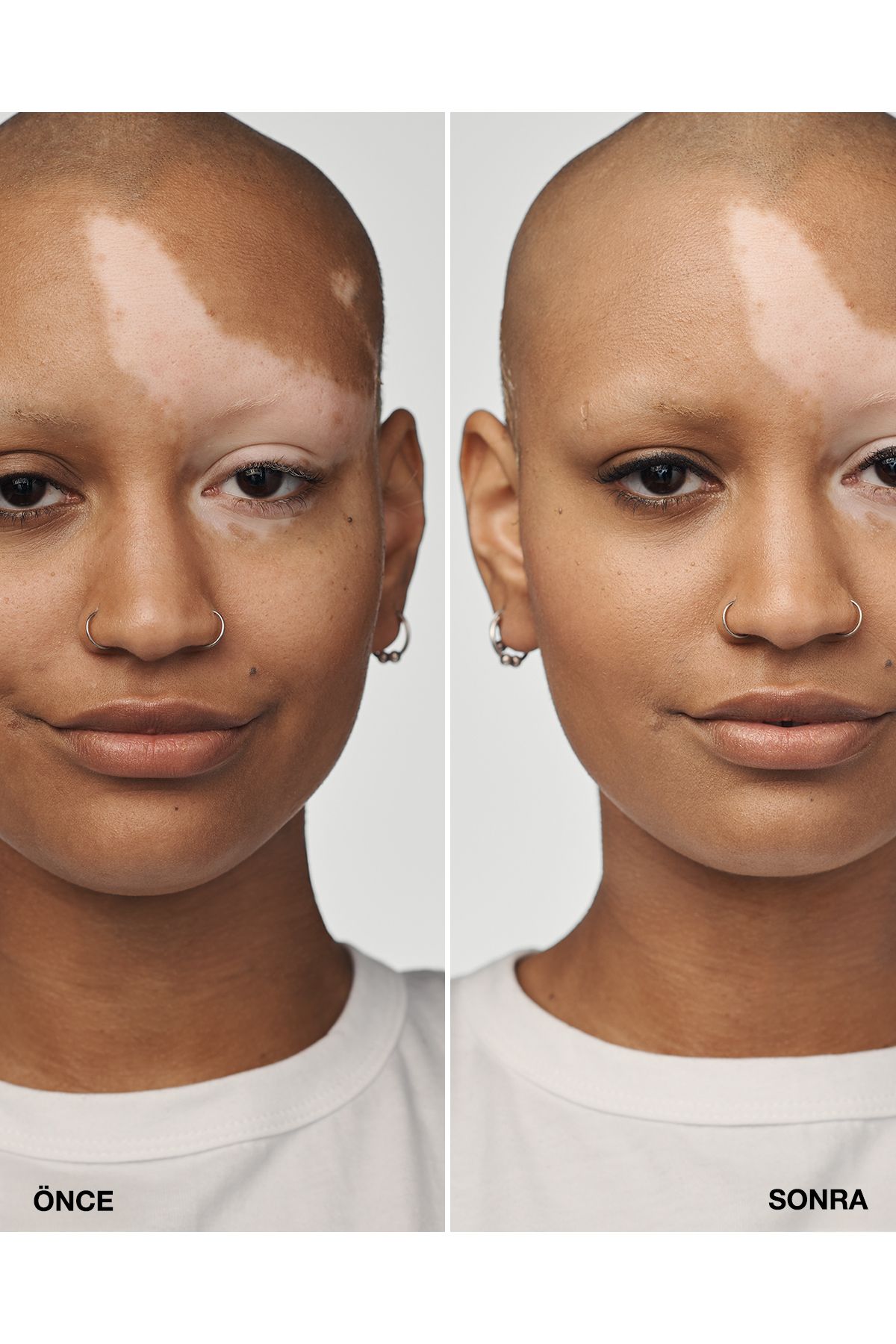 سرم Even Better Clinical™ Foundation SPF 20 - رنگ: CN 90 Sand (M) - 30ml Clinique