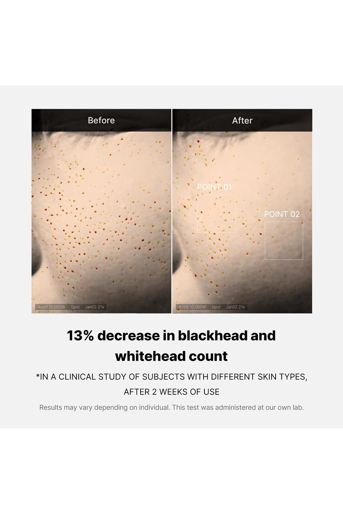 Medicube-Zero Pore Serum 1.01 oz - Overnight Resurfacing with AHA+BHA+PHA & Niacinamide 5