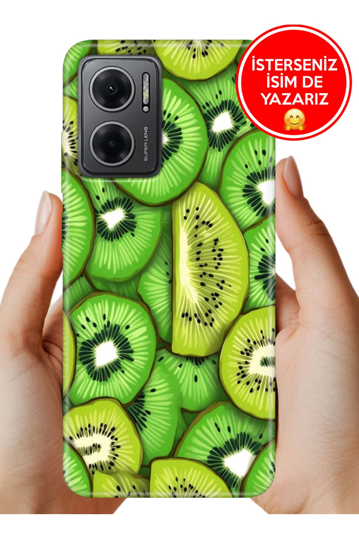 Cekuonline Redmi Note 11E Kılıf Kamera Korumalı Full Desen Arka Silikon Kivilogy