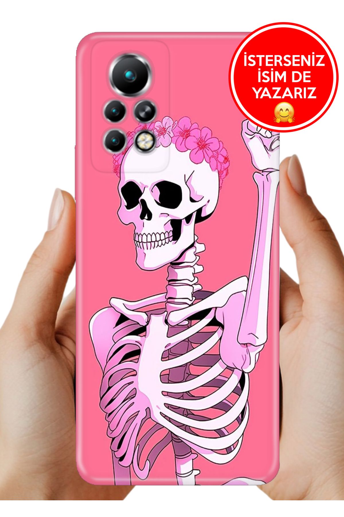 Cekuonline İnfinix Note 11 Pro X697 Kılıf Kamera Koruma Vip-Seri Esnek Silikon Missskull