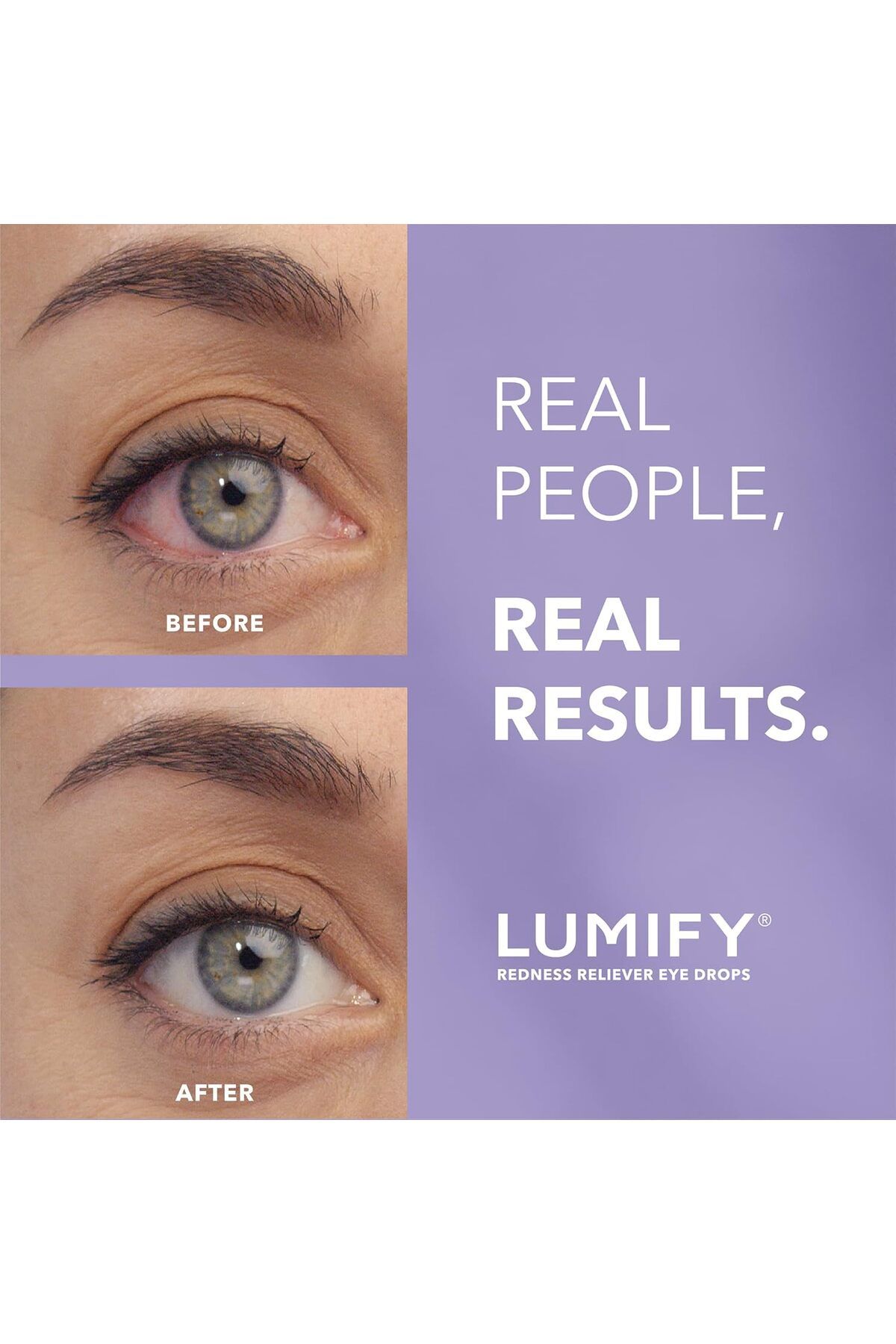 Lumify-Redness Reliever Eye Drops For Whiter & Brighter Looking Eyes 2.5 mL 4