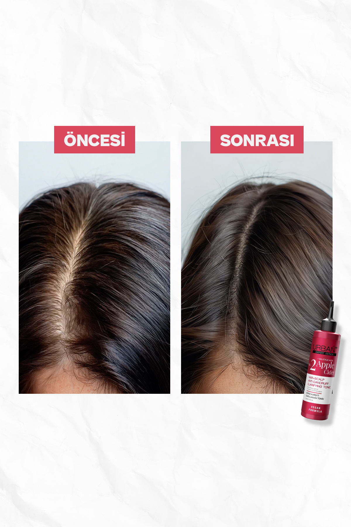 Expert Apple Cider Kepek Karşıtı Saç Bakım Seti Şampuan Tonik Peeling 3'lü-vegan — SET.URB.238 — تصویر 3 از 8