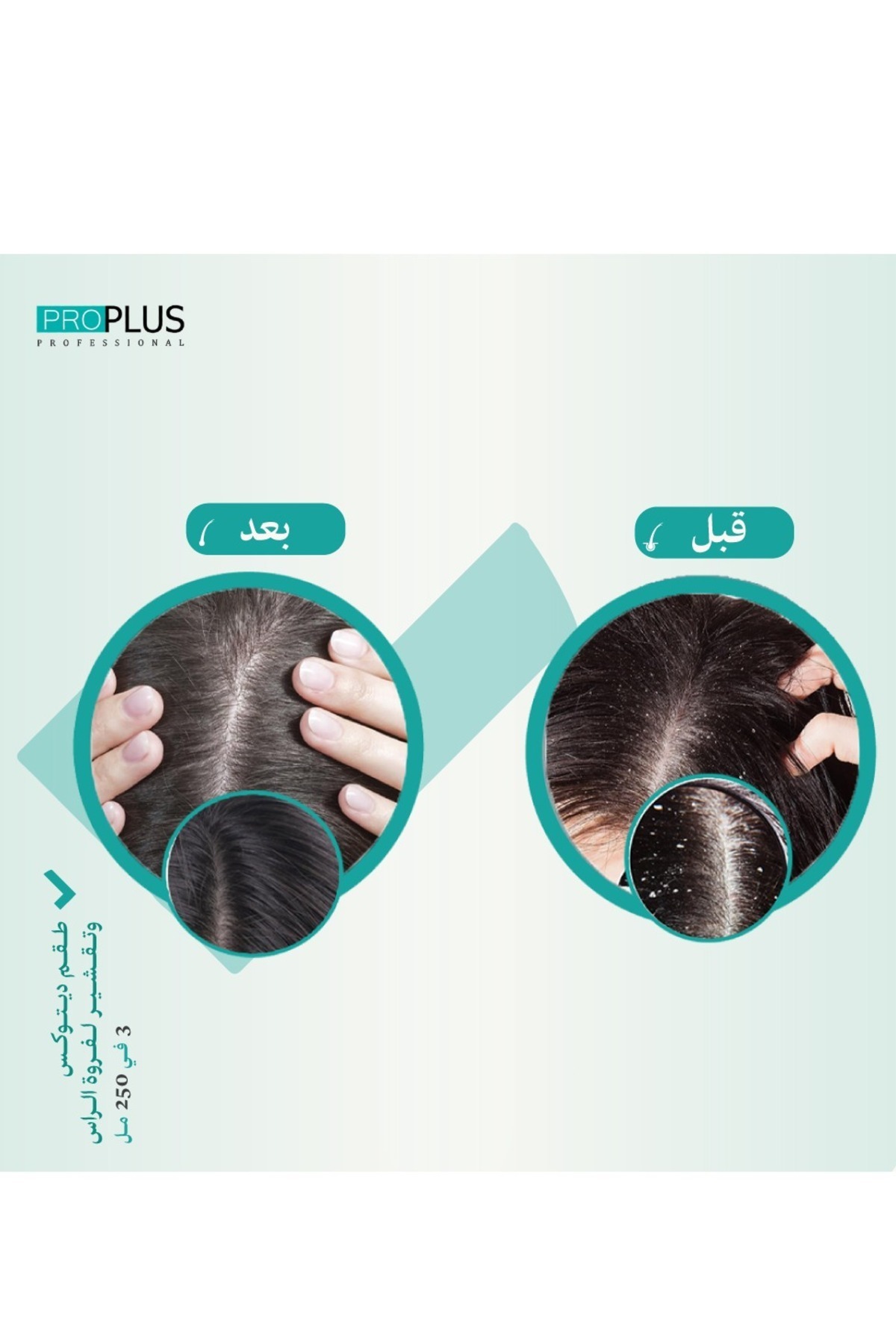 Pro Plus Professional-3-Step Detox Scalp Scrub Kit 250ml 4