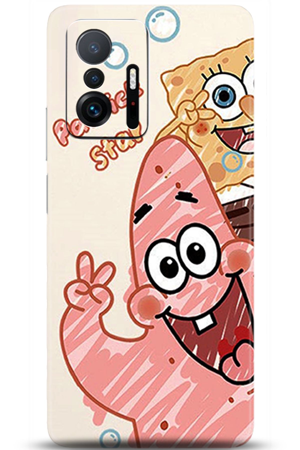 adveksiyon Xiaomi Mi 11T Kılıf HD Baskılı Kılıf - Pamper Yourself 5262