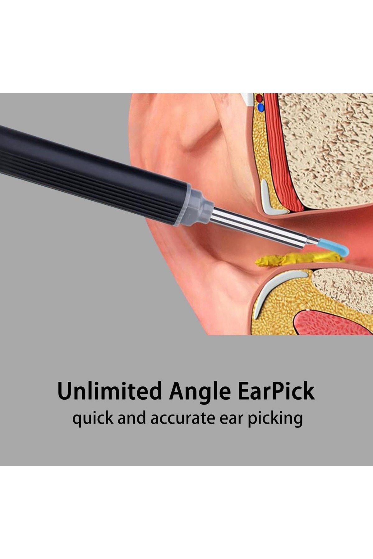 gaman NE3 Bebek ve Yetişkinler İçin USB Şarjlı Yedek Başlıklı Endoskop Kameralı Kulak Temizleme Cihazı fotoğrafı 5 (önizleme)