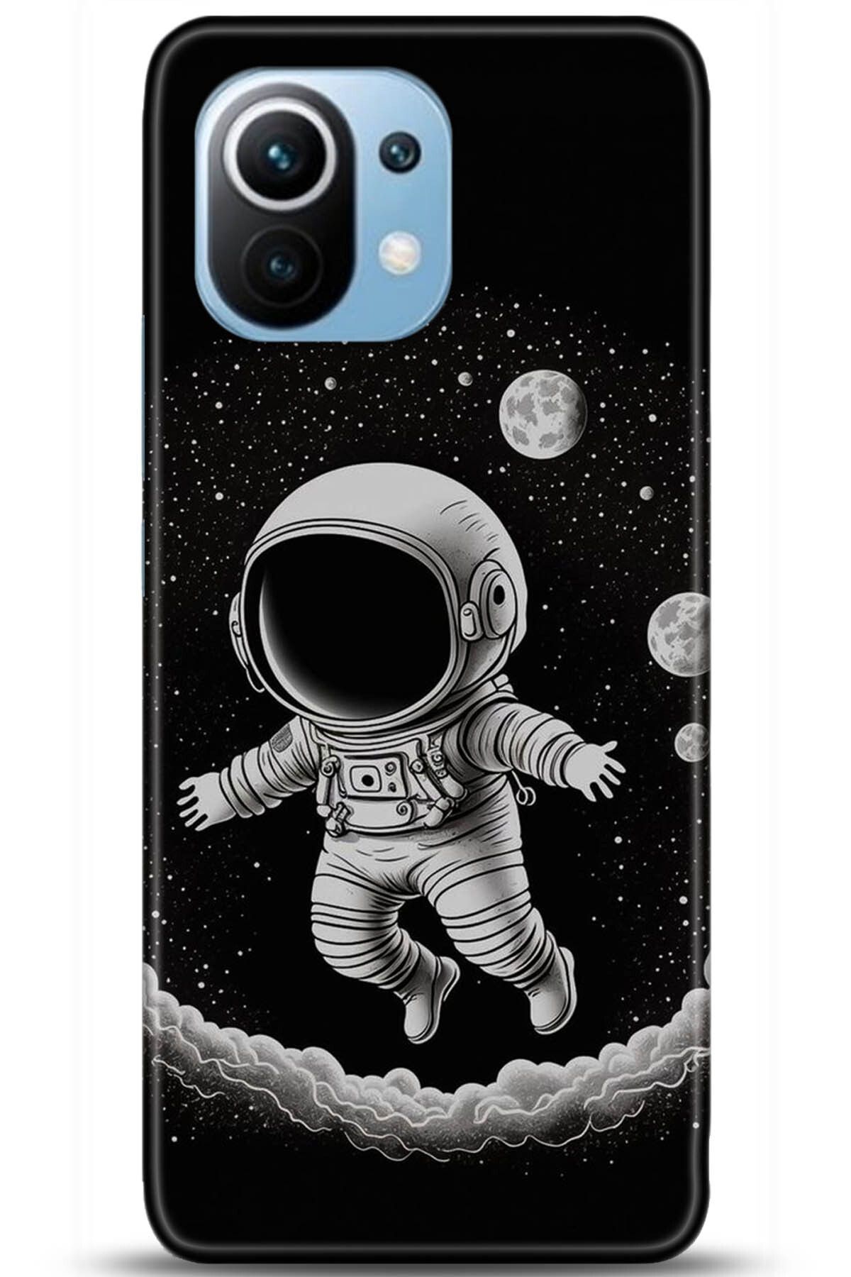 adveksiyon Xiaomi Mi 11 Kılıf HD Baskılı Kılıf - Pamper Yourself 5241