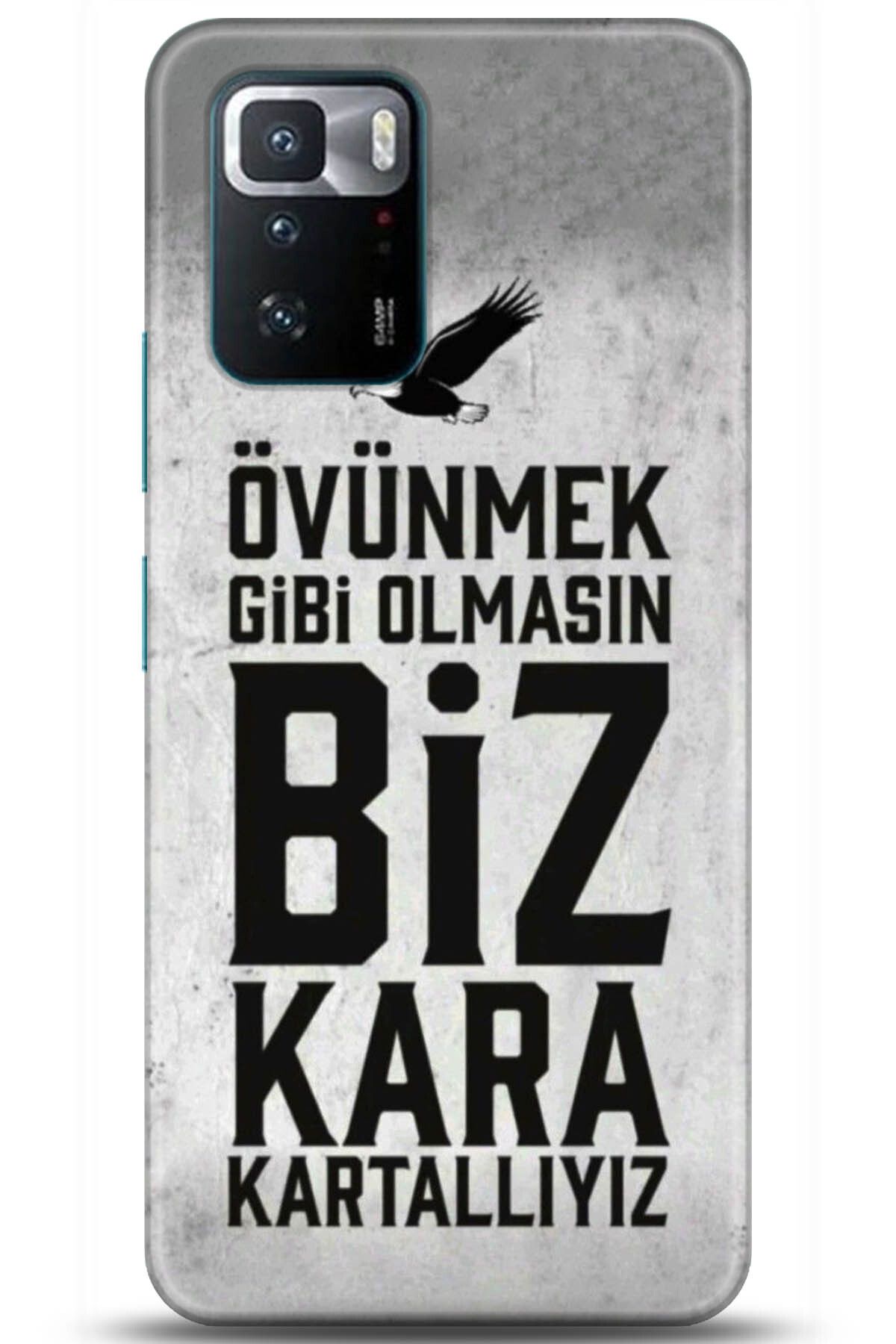 adveksiyon Xiaomi Poco X3 GT Kılıf HD Baskılı Kılıf - Pamper Yourself 5269