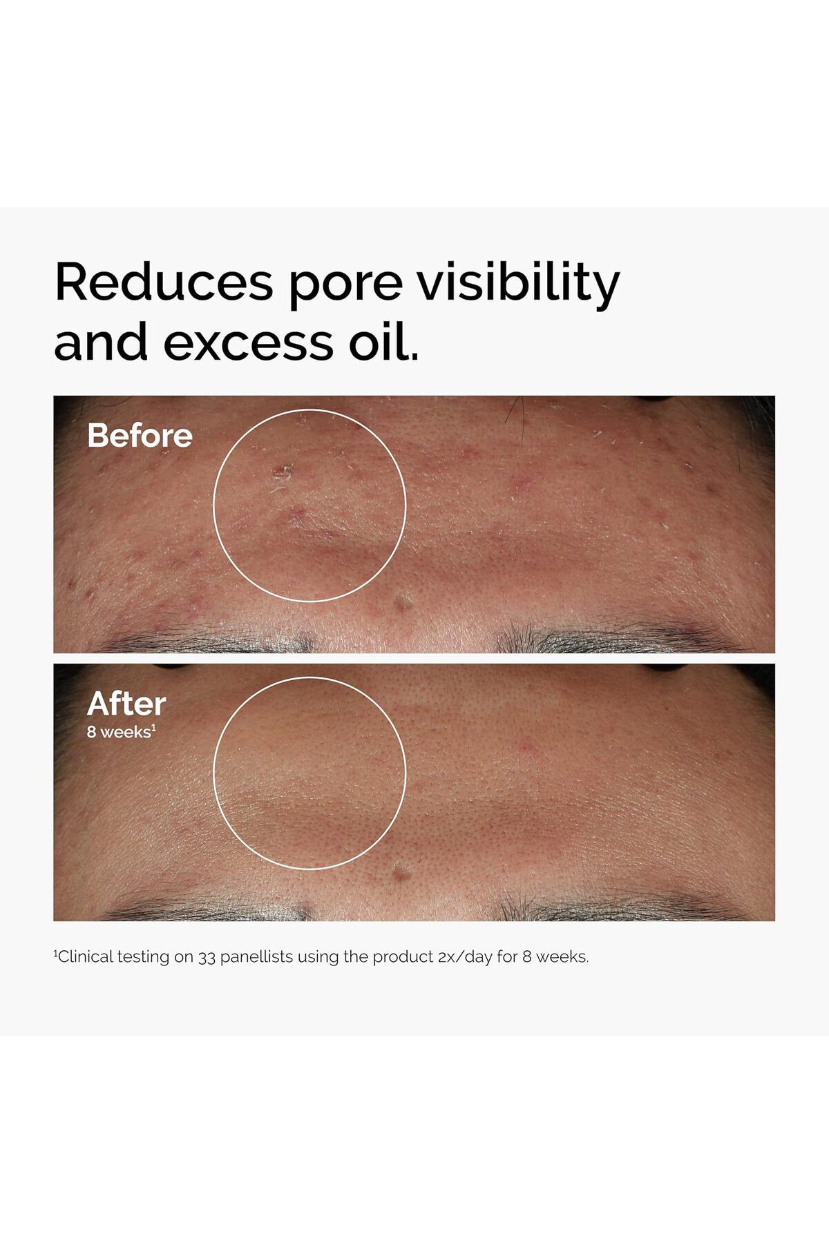The Ordinary-Niacinamide 10% Zinc 1% 30 ml 2