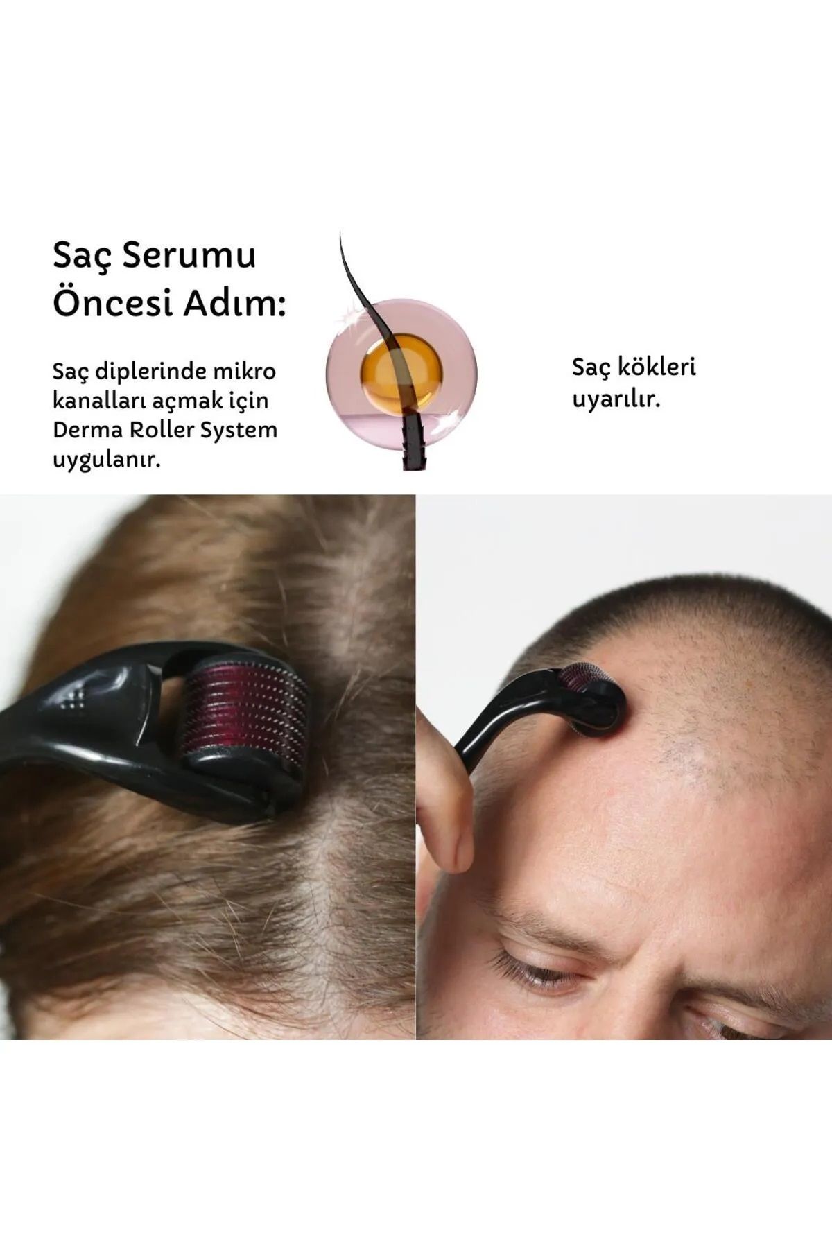 Atashoping DERMA ROLLER SYSTEM 0.5 MM
