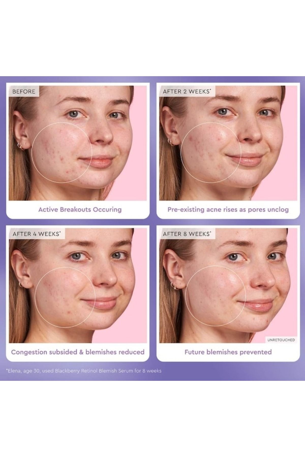 GLOW RECIPE-Blackberry Retinol Blemish Serum 30ml – Clarifying, Smoothing, and Pore-Refining Face Serum 3
