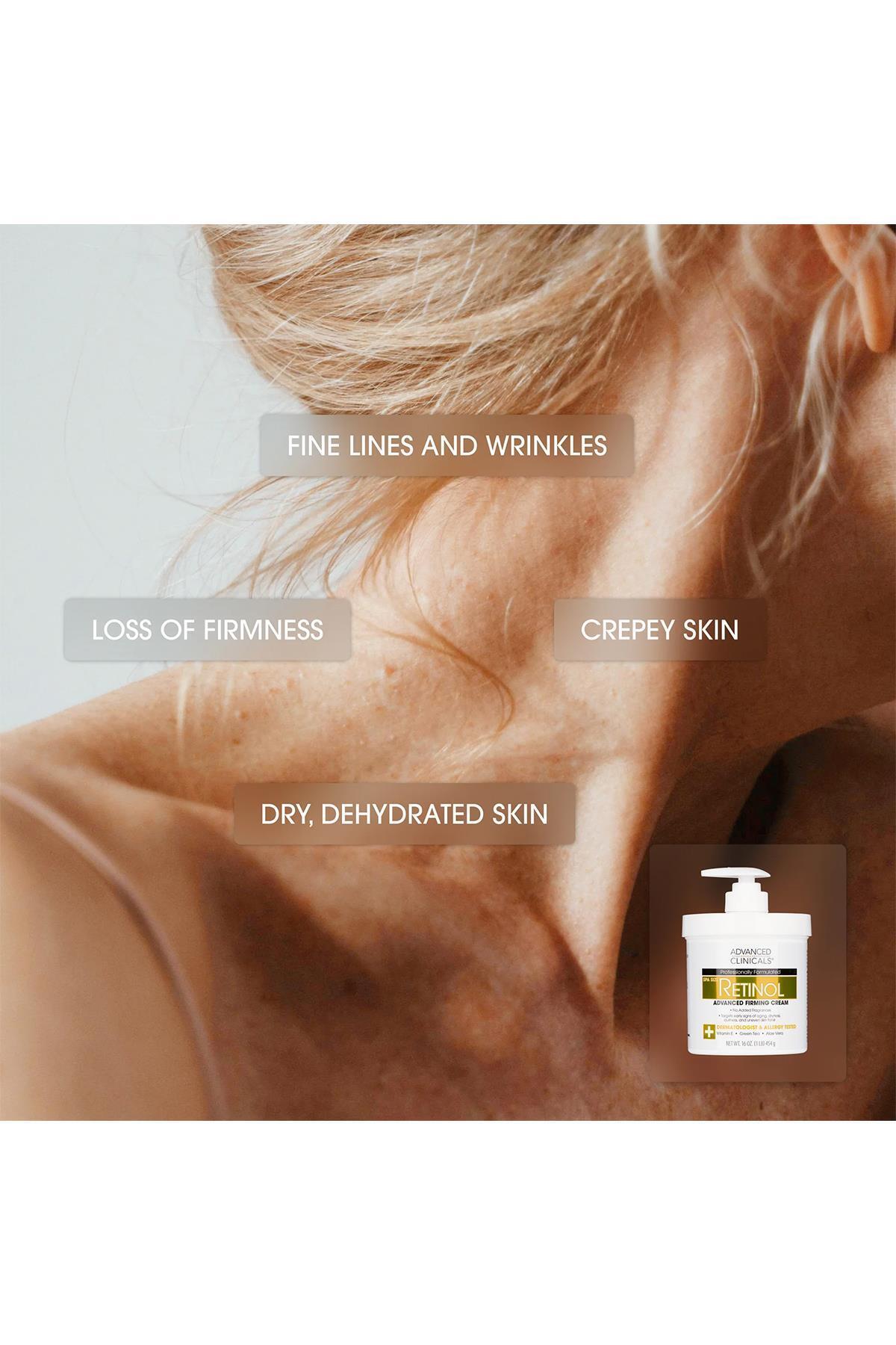 ADVANCED CLİNİCALS-Advanced Clinicals Retinol Firming Face and Body Cream 59ml 3
