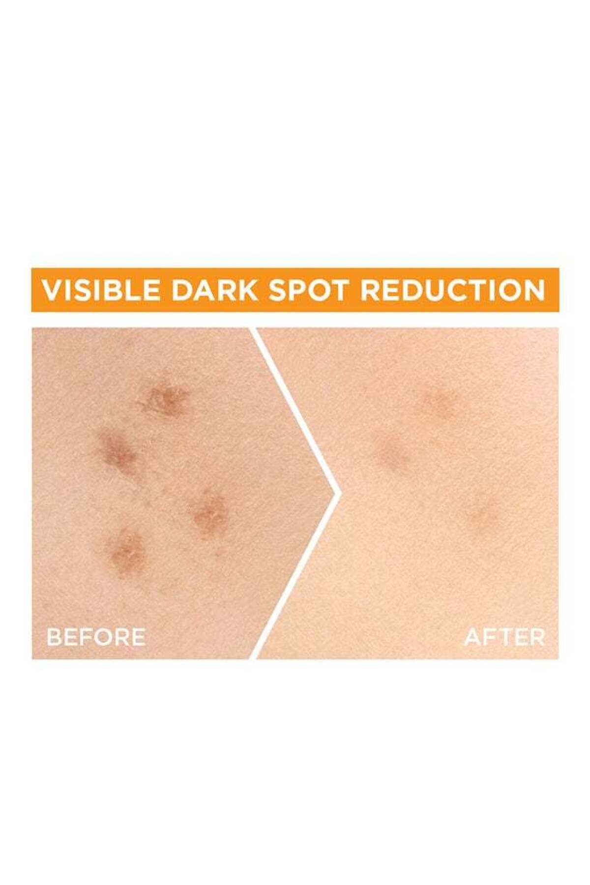 Garnier-Garnier Fast Bright 30x Vitamin C Anti-Dark Spot Serum - 30ml 2