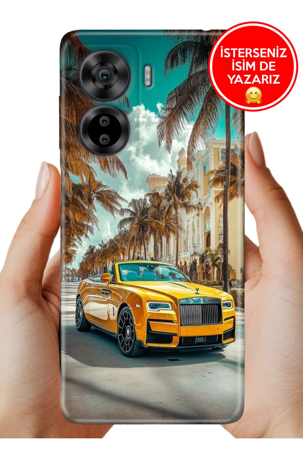 Cekuonline Casper Via X40 Kılıf Desenli Baskılı Kamera Korumalı ZRR Silikon Rolls
