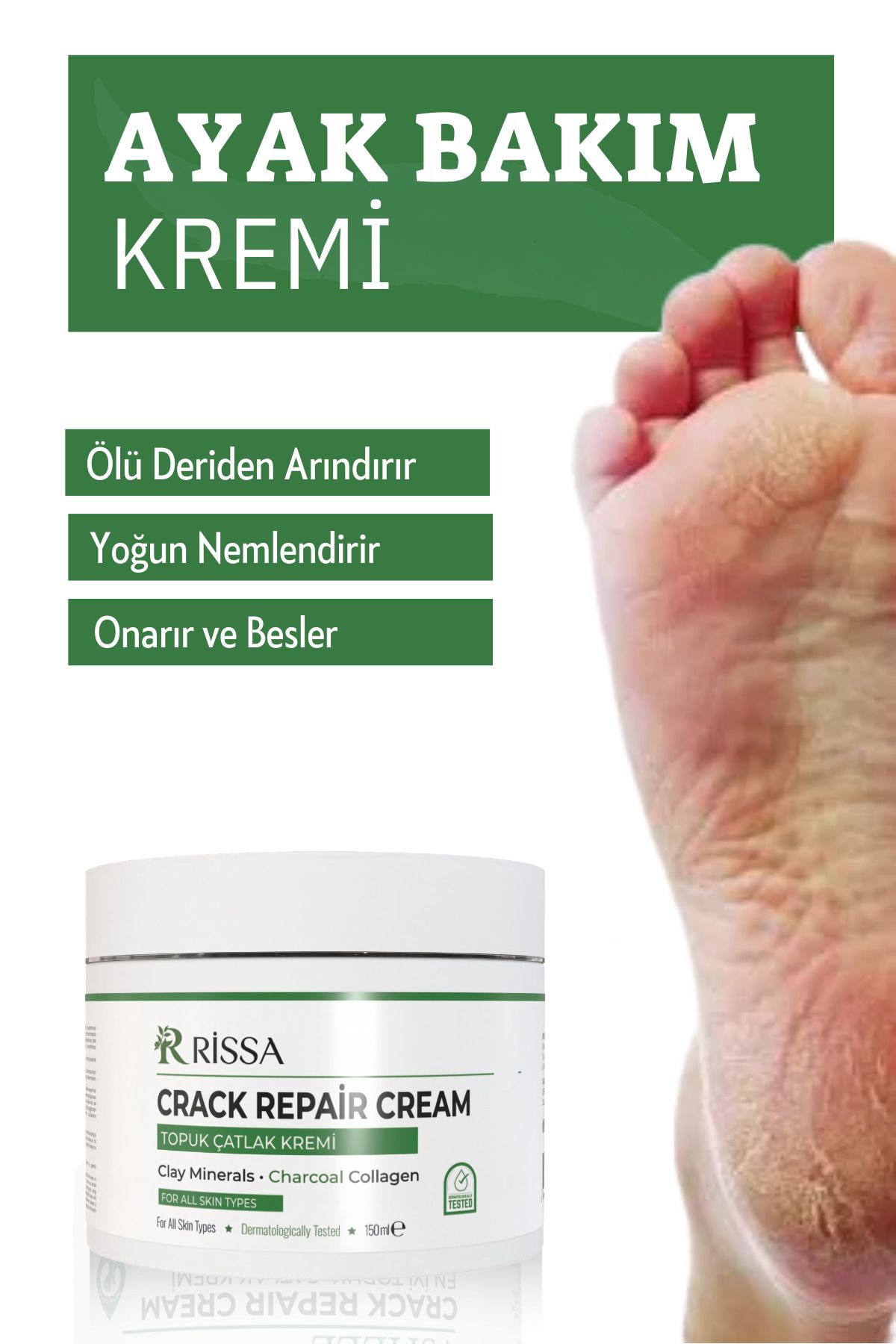 Rissa Ayak, Topuk, Çatlak, Mantar, Koku, Ve Diyabetik Yaralar Için Nemlendirici Bakım Kremi