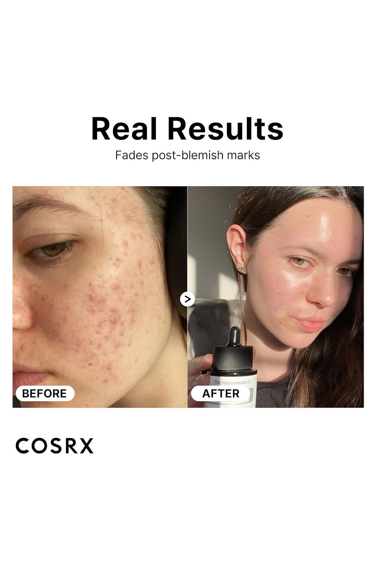 Cosrx-The Niacinamide 15 Serum 20ml – Anti-Acne Brightening Ampoule for Clear, Balanced Skin 6
