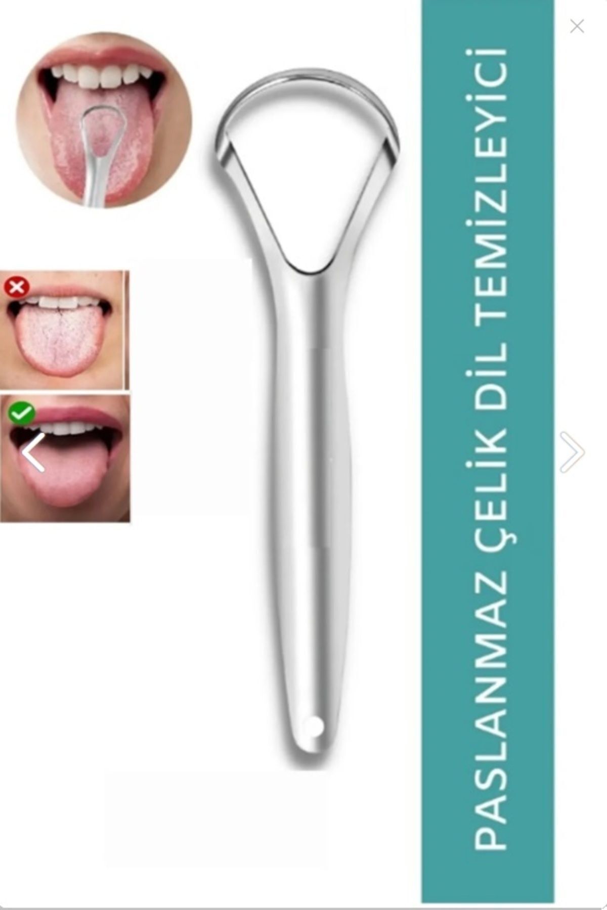 Miomi-Tongue Cleaning Apparatus Tongue Scraping Stick Cleaner Scraper Stripper 4