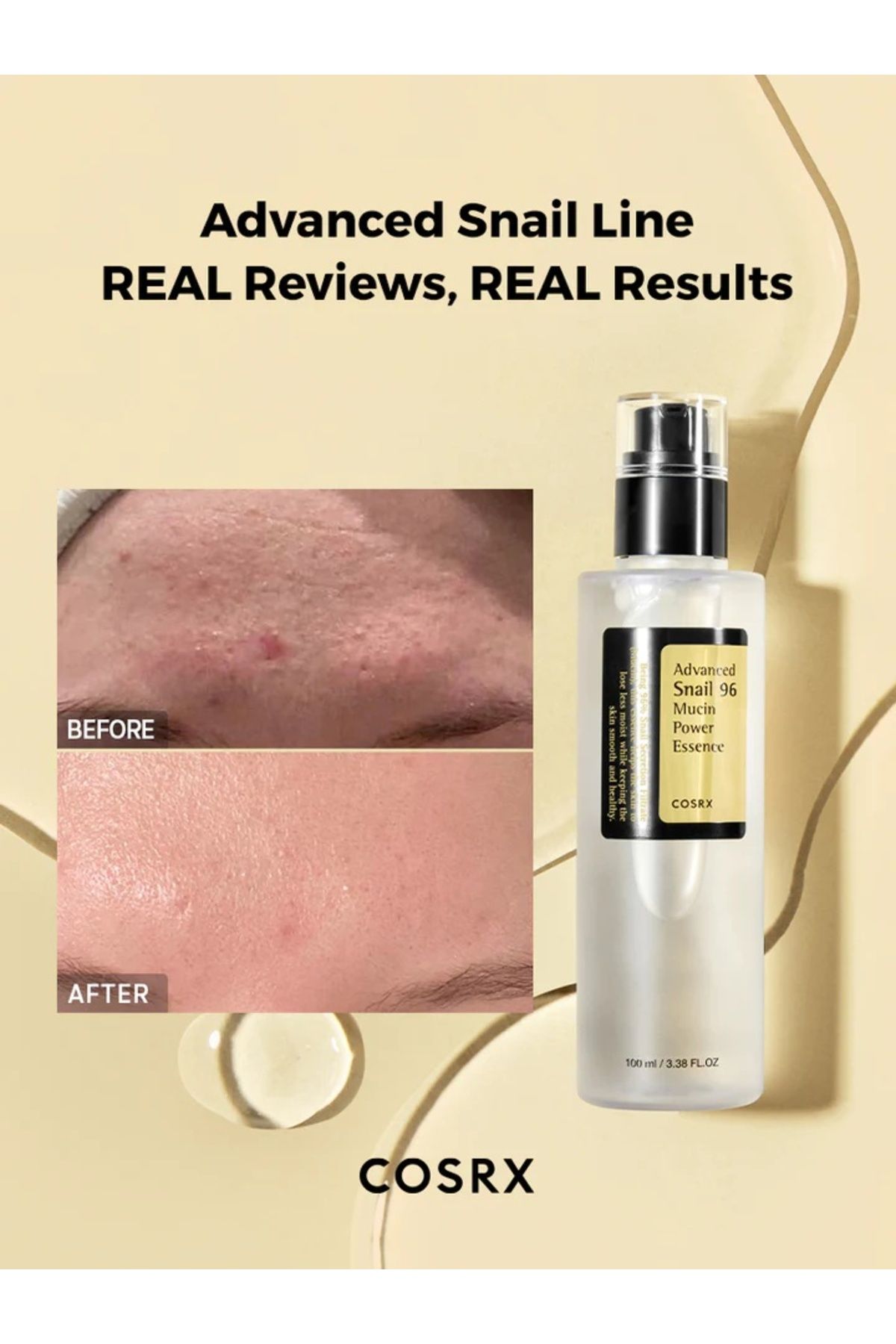 Cosrx-Ser cu extract concentrat de melc Advanced Snail 96 Mucin Power Essence, 100ml 2